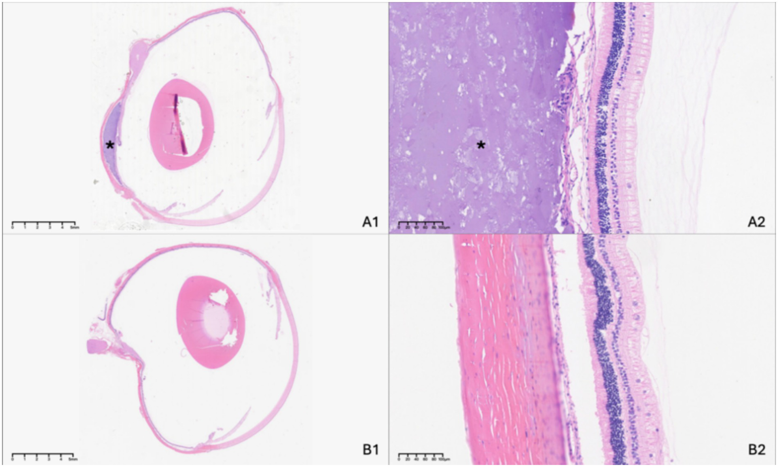 Histological images comparing two eye sections stained with hematoxylin and eosin. Panels A1 and A2 show a section with possible tissue damage or abnormality marked by asterisks. Panels B1 and B2 display a section with more uniform tissue integrity. Each panel contains scale bars for reference.