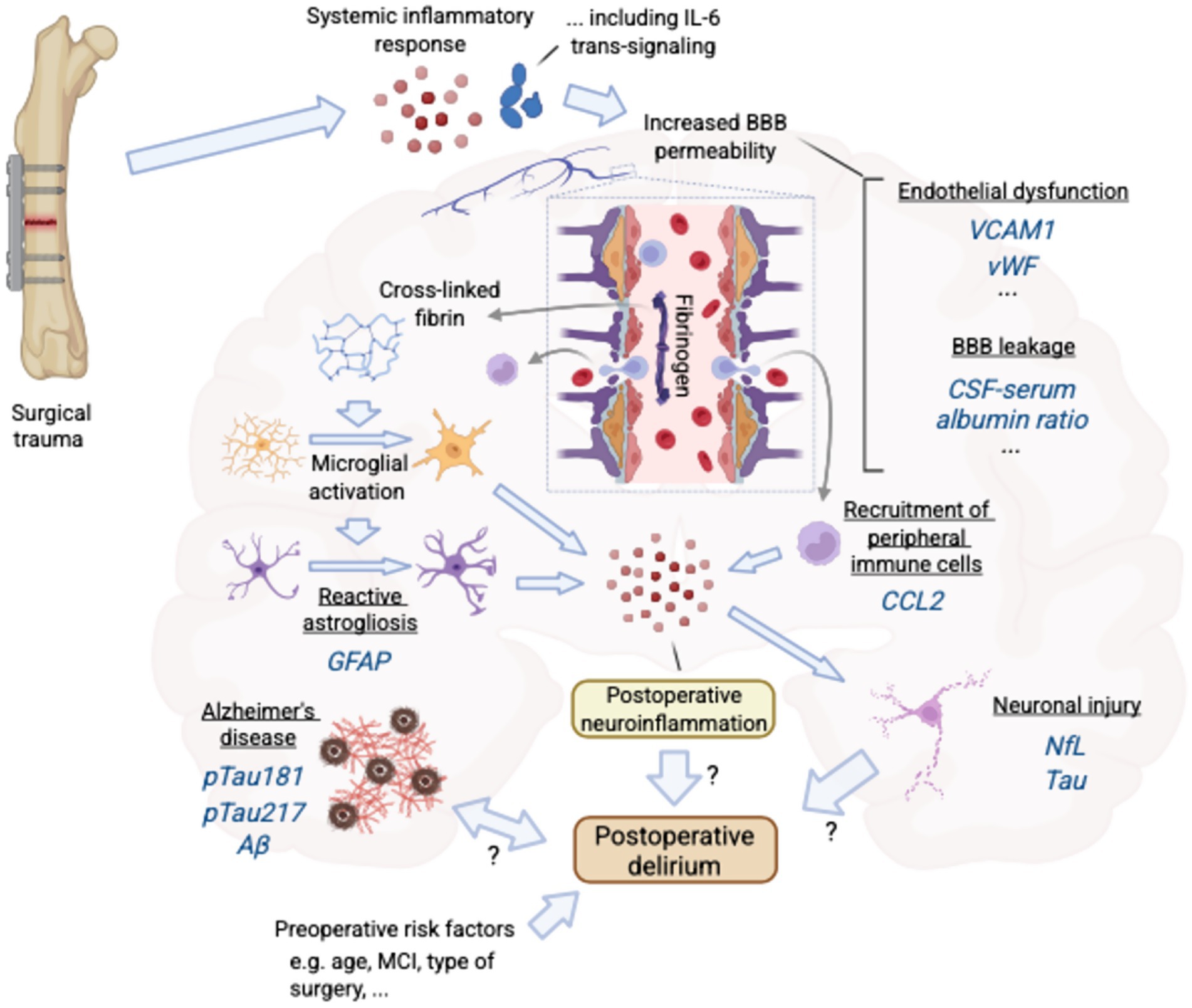 Flowchart illustrating the pathophysiology of postoperative delirium. Surgical trauma leads to a systemic inflammatory response and increased blood-brain barrier (BBB) permeability., with recruitment of peripheral immune cells into the brain parenchyma. Microglial activation and reactive astrogliosis follow,.. Postoperative neuroinflammation occurs, potentially causing neuronal injury and resulting in postoperative delirium.. Underlying Alzheimer's disease neuropathology may also contribute to neuroinflammation and postoperative delirium. Preoperative risk factors like age and type of surgery are noted as contributors to postoperative delirium as well.