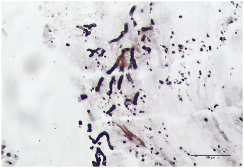 Microscopic image showing clusters of dark Aspergillus fumigatus hyphae scattered across a light background. Some areas appear denser with more concentrated fungi presence. A scale bar at the bottom indicates a length of fifty micrometers.