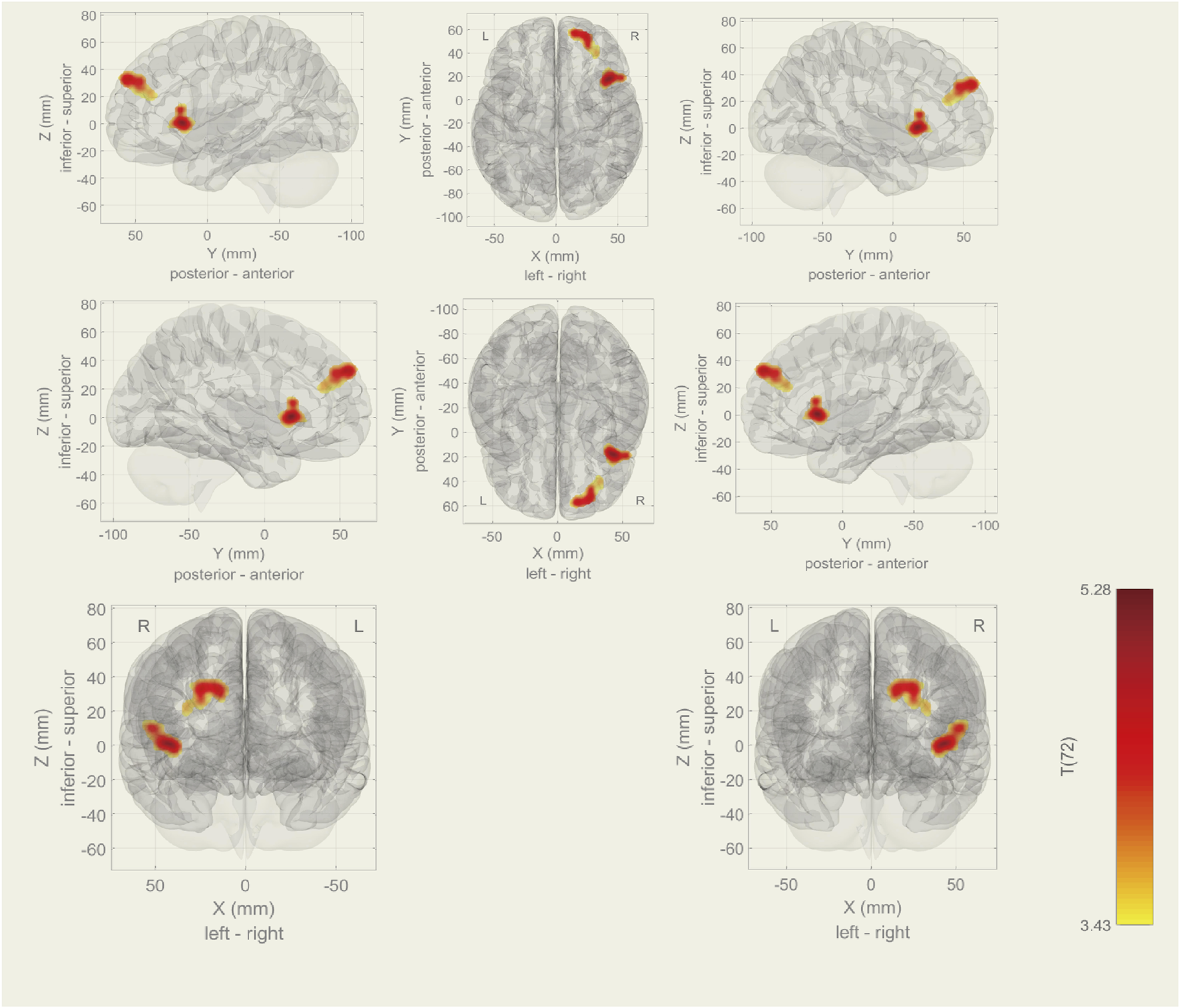 Brain imaging visualizations with sagittal, coronal, and axial views highlighting regions of activation in red and yellow. Axes are labeled for Y (posterior-anterior), X (left-right), and Z (inferior-superior) dimensions. A color scale to the right indicates intensity values ranging from 3.43 to 5.28.