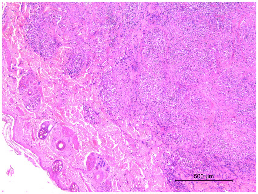 Histological slide showing a tissue section under a microscope. The image is stained with hematoxylin and eosin, highlighting cellular structures with shades of pink and purple. A scale bar indicates a measurement of five hundred micrometers.