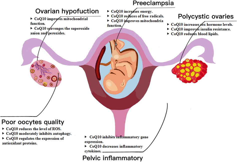 Diagram of a uterus and ovaries labeled with conditions and benefits of CoQ10. Ovarian hypofunction, preeclampsia, polycystic ovaries, poor oocyte quality, and pelvic inflammation are noted. CoQ10's benefits include improved mitochondrial function, reduced free radicals, increased energy, improved insulin resistance, and reduced inflammatory cytokines.