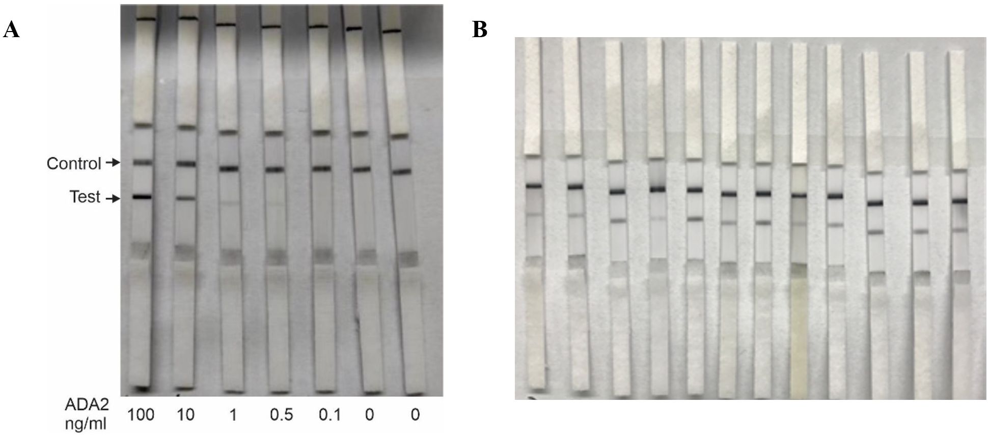 Lateral flow strips are displayed in two sections labeled A and B. Section A shows strips with control and test lines, with ADA2 concentrations ranging from 100 to 0 nanograms per milliliter. Section B shows additional strips without specified concentrations.