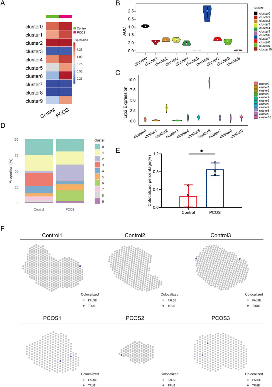 A series of data visualizations comparing control and PCOS groups. A) Heatmap of expression levels across ten clusters. B) Violin plot showing AUC values for each cluster. C) Violin plot displaying Lrp2 expression levels. D) Stacked bar chart showing cluster proportions in control and PCOS. E) Bar graph indicating colocalized percentage, with PCOS showing significantly higher values. F) Hexbin plots for three control and three PCOS samples, highlighting colocalization points.