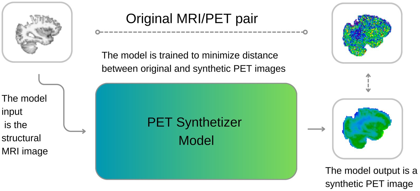 Diagram showing a PET Synthesizer Model. On the left, the model input is a structural MRI image. The model is trained to minimize the distance between original and synthetic PET images. On the right, the model output is a synthetic PET image.