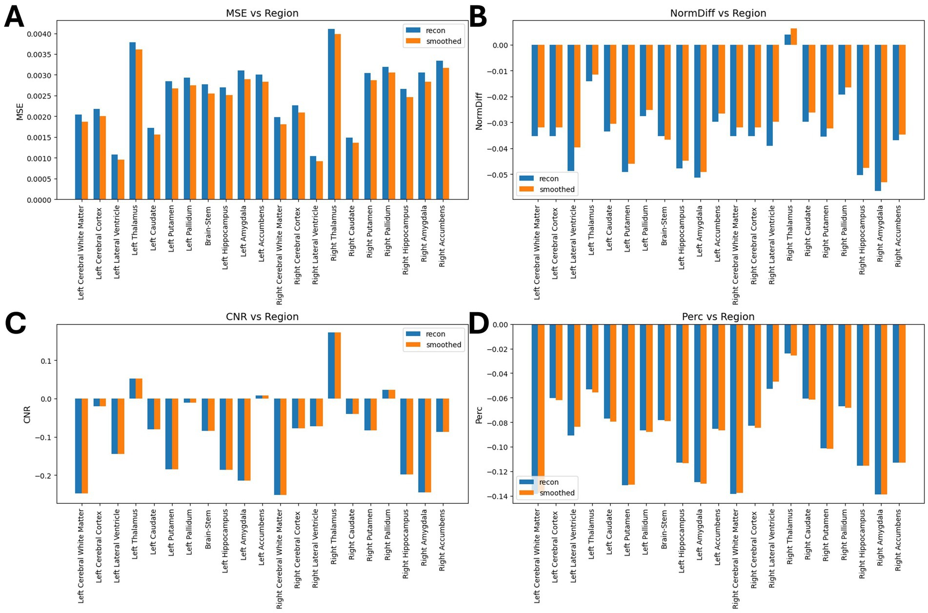 Four bar charts labeled A, B, C, and D compare metrics across brain regions. Chart A shows MSE values; Chart B depicts NormDiff; Chart C presents CNR; Chart D illustrates Perc. Each chart features blue (recon) and orange (smoothed) bars for each brain region, including the cerebral cortex, thalamus, and hippocampus. Legend indicates colors correspond to recon and smoothed data.