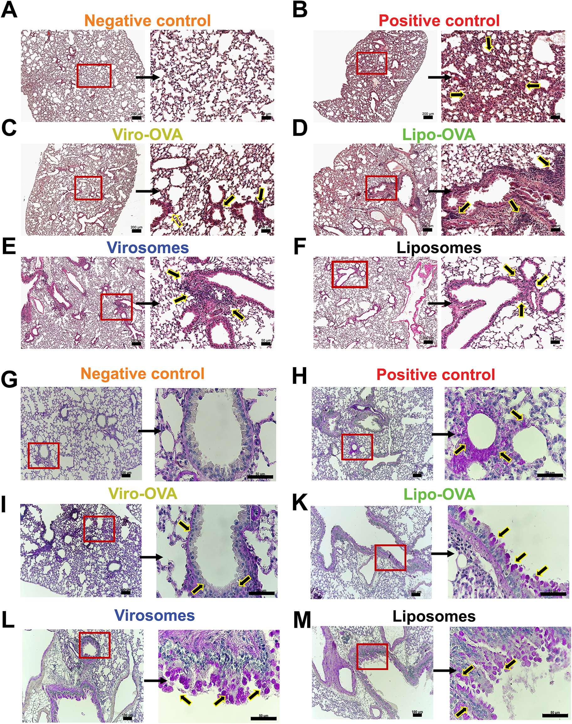 Panels A to M display microscopic images of lung tissue sections stained to compare different treatments. Each set of paired images includes a lower magnification view on the left and a higher magnification focus on a red-outlined area on the right. Labels above the images indicate different treatments: Negative control, Positive control, Viro-OVA, Lipo-OVA, Virosomes, and Liposomes. Yellow arrows point to specific features within the tissues, demonstrating varied tissue responses to the treatments. The sections show differences in inflammation, cell infiltration, and structural alterations, with scale bars for size reference.