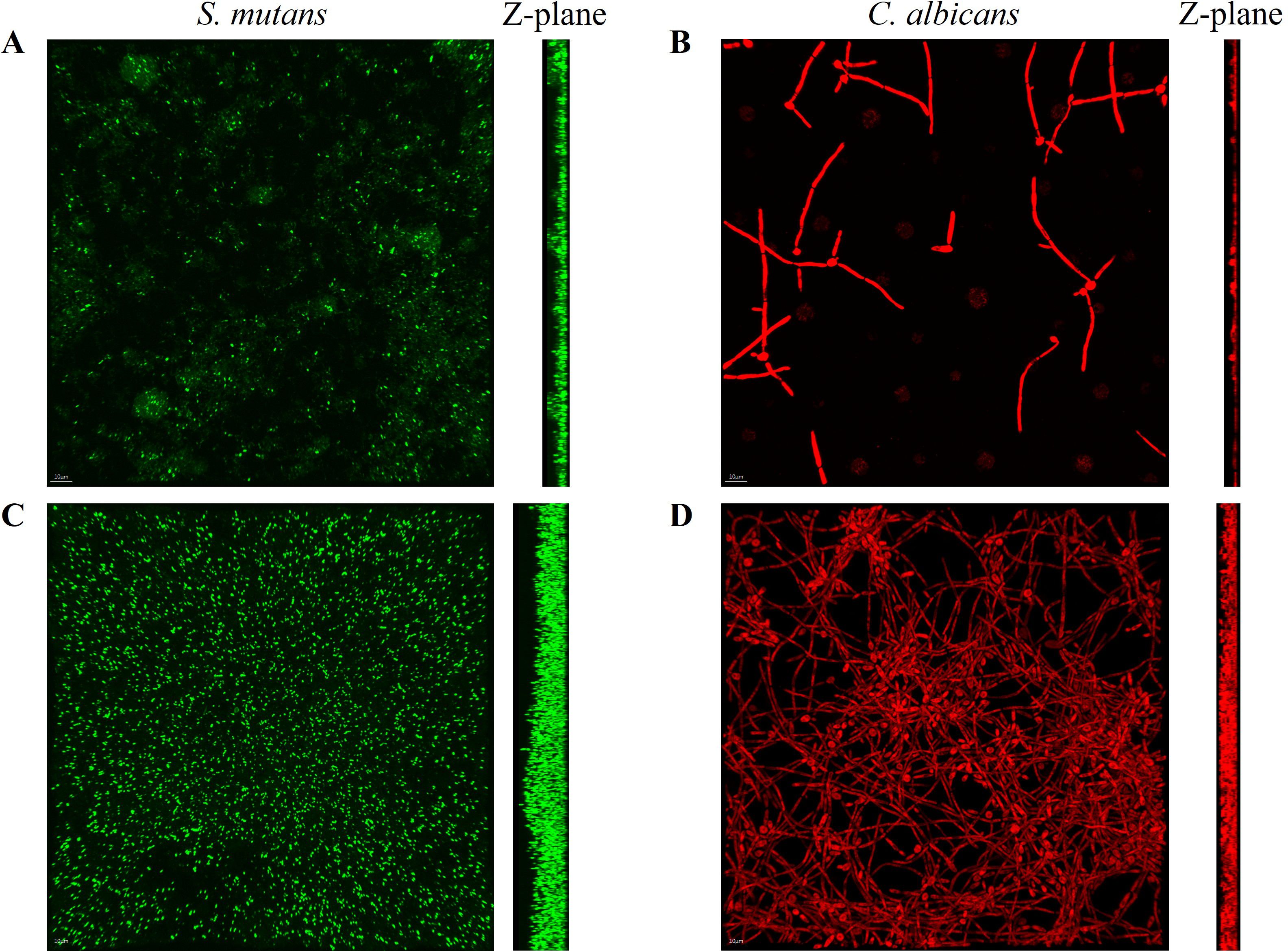 Fluorescence microscopy images showing biofilms. Panel A displays *S. mutans* in green with its Z-plane section on the right. Panel B shows *C. albicans* in red with its Z-plane section. Panel C illustrates a denser *S. mutans* biofilm in green in the control group without arginine. Panel D presents a complex network of *C. albicans* in red in the control group without arginine, with corresponding Z-plane sections for each.