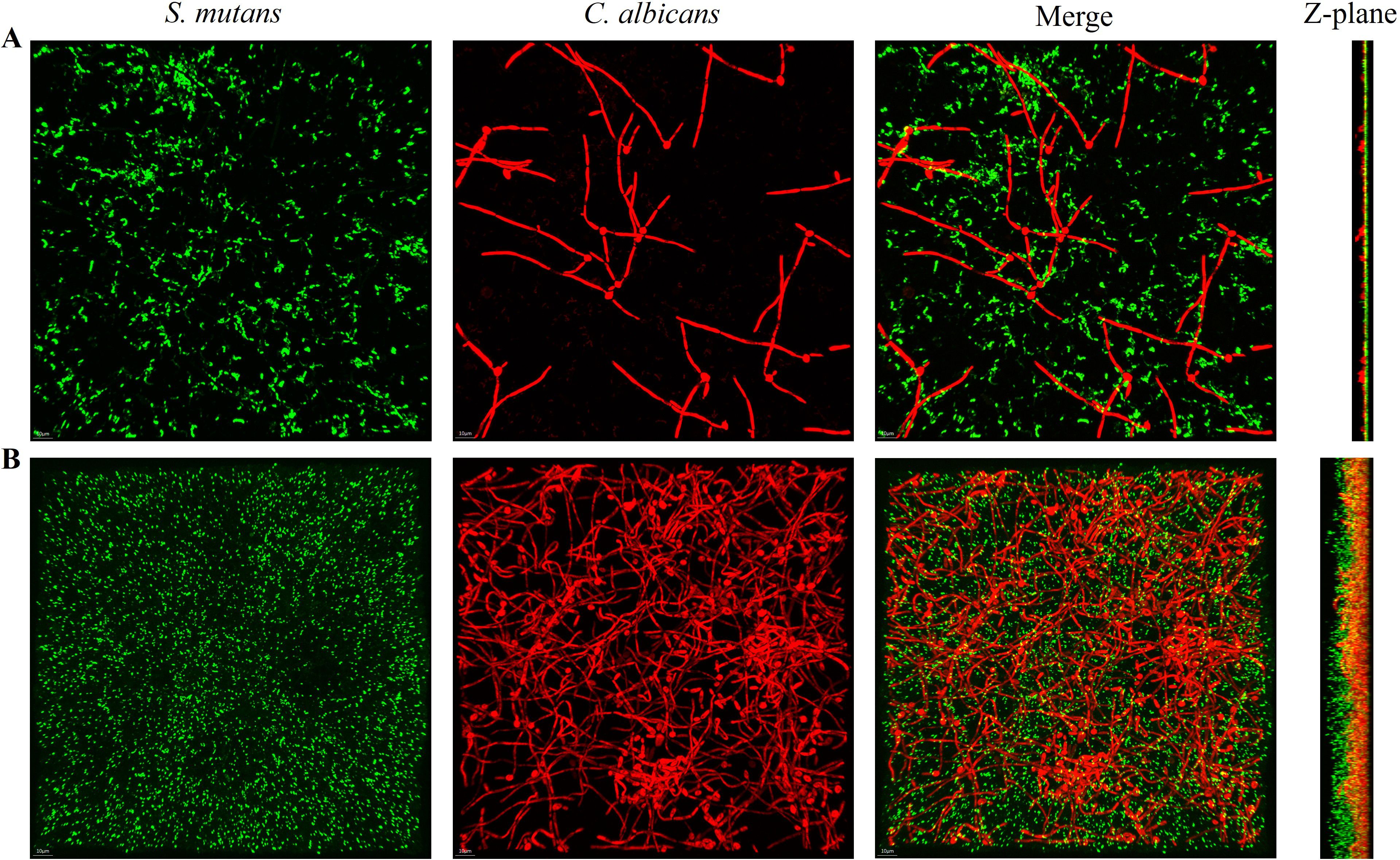 Fluorescence microscopy images showing biofilms. Each panel has four sub-images: green S. mutans, red C. albicans, a merged image of both, and a Z-plane view on the right. Panel A shows the experimental groups and panel B shows the control groups.
