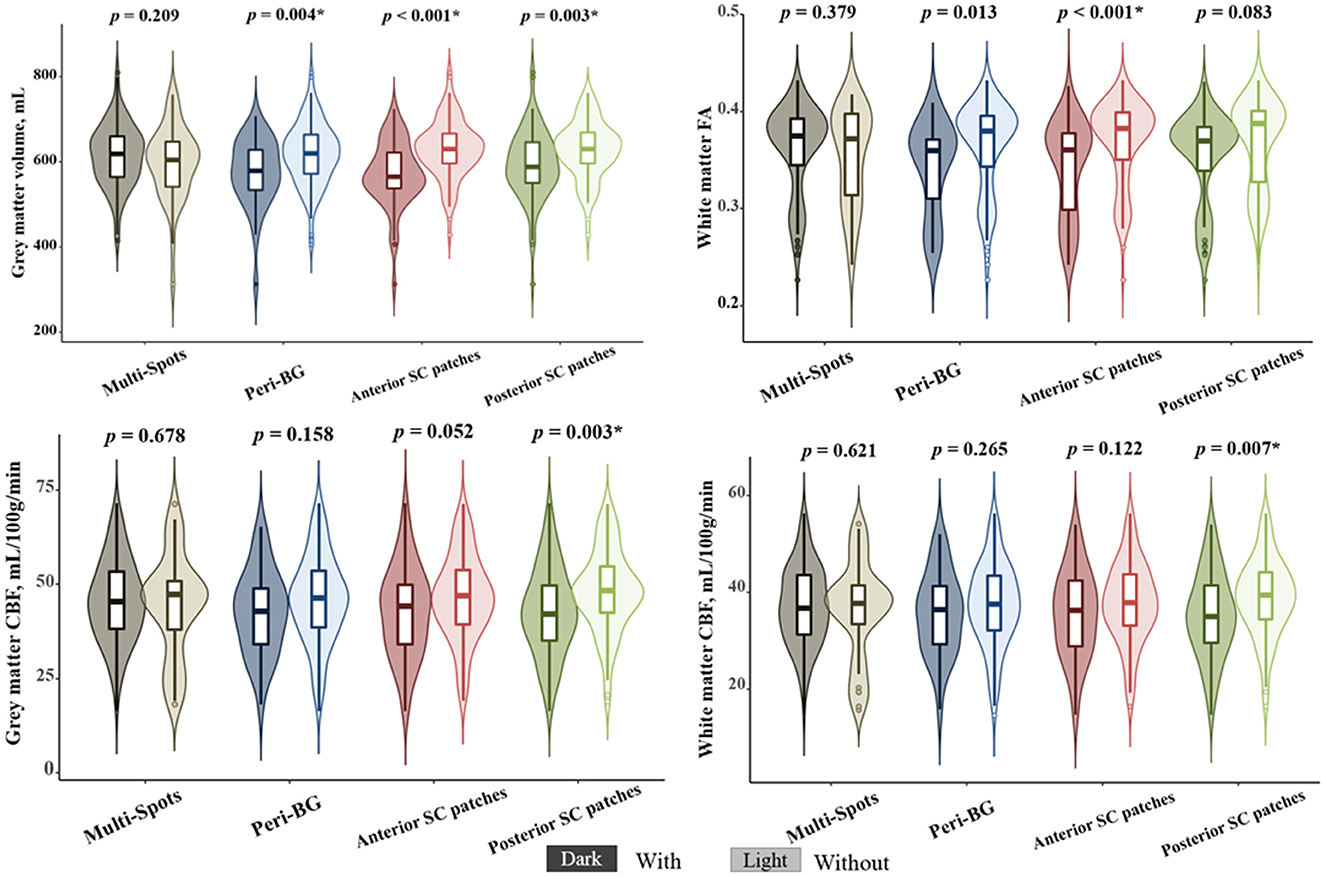 Four violin plots displaying data on brain metrics such as grey matter volume, white matter fractional anisotropy (FA), grey matter cerebral blood flow (CBF), and white matter CBF. The plots compare different brain regions: multi-spots, peri-BG, anterior SC patches, and posterior SC patches. P-values are noted above each plot; significant values are marked with an asterisk. Various shades of color differentiate each region. A legend indicating “Dark,” “Light,” and “Without” is positioned at the bottom.