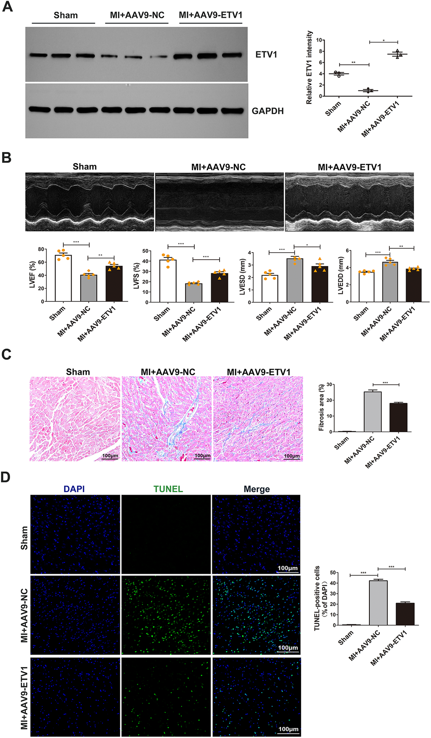Panel A shows Western blot analysis of ETV1 expression in Sham, MI+AAV9-NC, and MI+AAV9-ETV1 groups with a bar graph indicating relative intensity. Panel B features echocardiography images and graphs of cardiac function parameters: LVEF, LVFS, LVESD, and LVEDD. Panel C presents histological sections using Masson's trichrome staining to assess fibrosis, with a graph showing fibrosis area percentage. Panel D shows TUNEL assay images for cell apoptosis with a graph displaying TUNEL-positive cell percentage. Each panel compares the effects across the three groups.