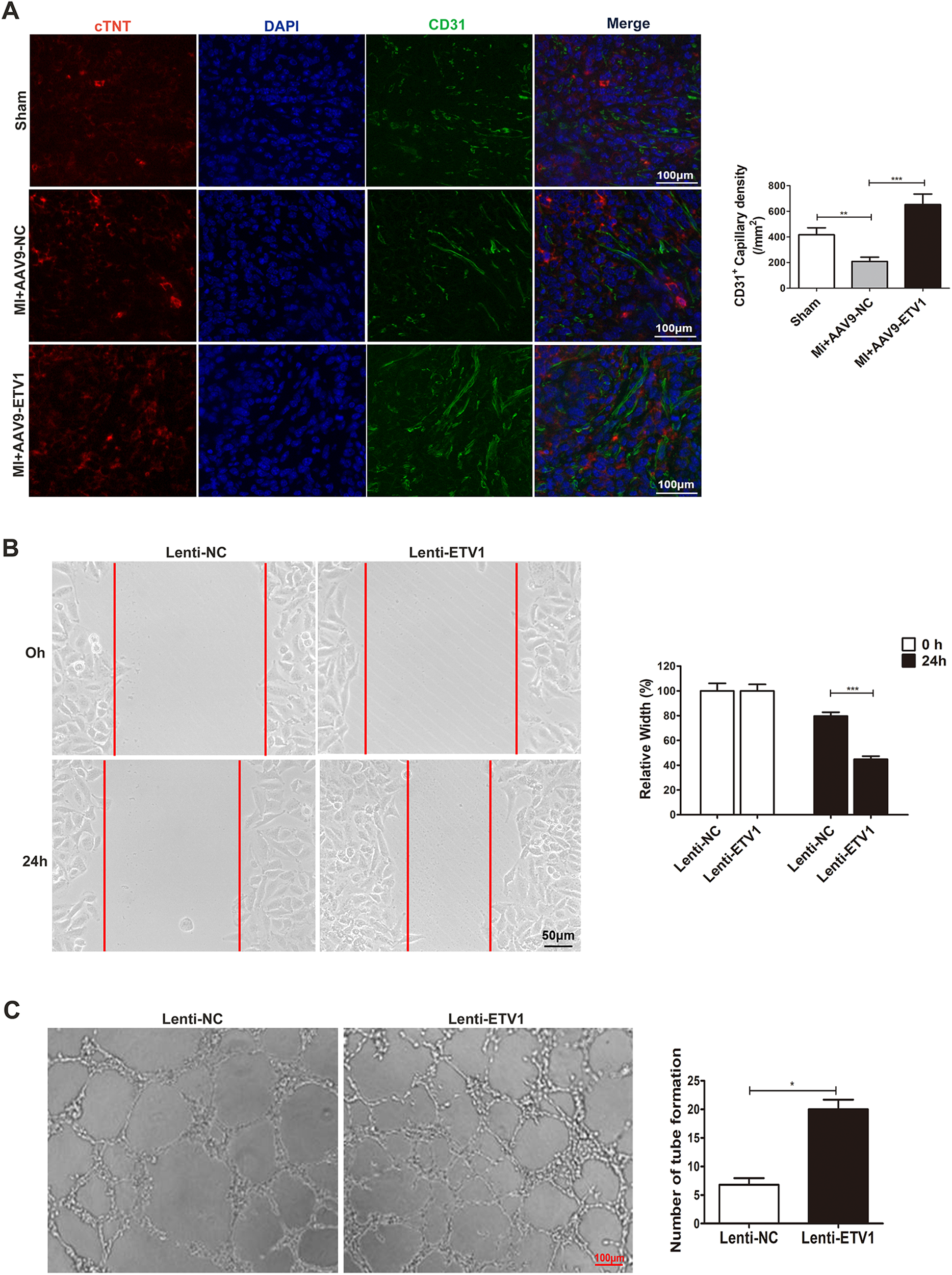 (A) Series of immunofluorescence images showing cTNT (red), DAPI (blue), and CD31 (green) staining with merged images in heart tissues: Sham, Mif-AAV9-NC, and Mif-AAV9-ETV1 groups. A bar graph compares CD31+ capillary density among groups with significant differences. (B) Microscopy images of a scratch assay at 0 hours and 24 hours for Lenti-NC and Lenti-ETV1 groups. A bar graph shows relative wound width with significant differences over time. (C) Tube formation assay images for Lenti-NC and Lenti-ETV1 groups. Bar graph shows the number of tube formations with significant increase in Lenti-ETV1.