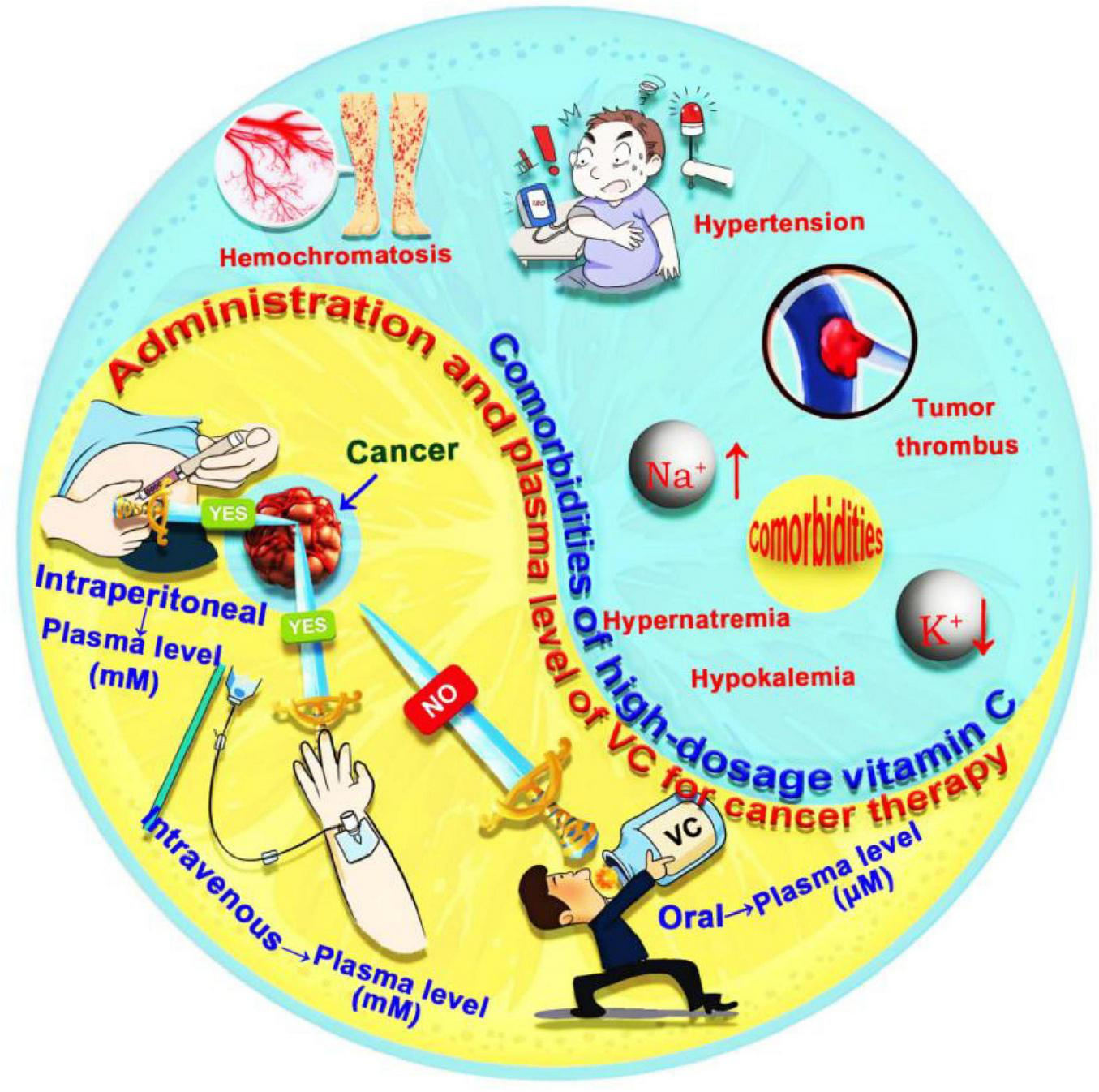 Illustration showing the administration and effects of high-dosage vitamin C for cancer therapy. The left side displays intraperitoneal and intravenous methods labeled “YES” for higher plasma levels in millimoles. The oral method is marked “NO” with lower plasma levels in micromoles. The right side highlights comorbidities such as hemochromatosis, hypertension, hypernatremia, hypokalemia, and tumor thrombus, with illustrations depicting these conditions. The illustration uses vibrant colors and various symbols to convey its message.