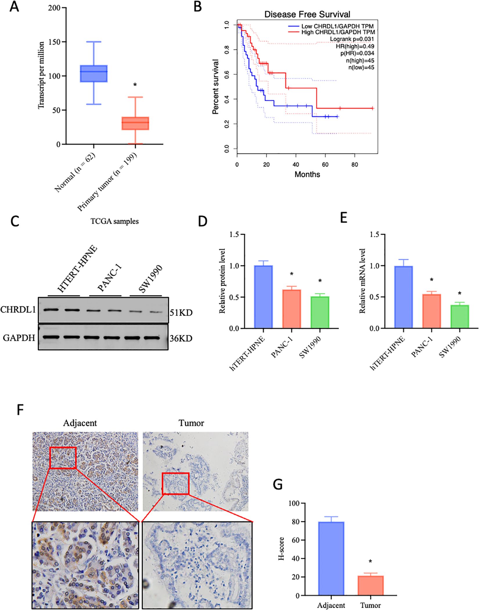 Panel A shows a box plot comparing transcript levels per million for normal and primary tumor samples, with lower levels in tumors. Panel B is a survival curve indicating lower disease-free survival for high CHRDL1/GAPDH TPM levels. Panel C displays a Western blot of CHRDL1 and GAPDH across three cell lines. Panels D and E show bar graphs illustrating relative protein and mRNA levels, with lower levels in tumor samples. Panel F contains immunohistochemistry images comparing adjacent and tumor tissues, with less staining in tumor. Panel G is a bar graph with H-scores, lower in tumors.
