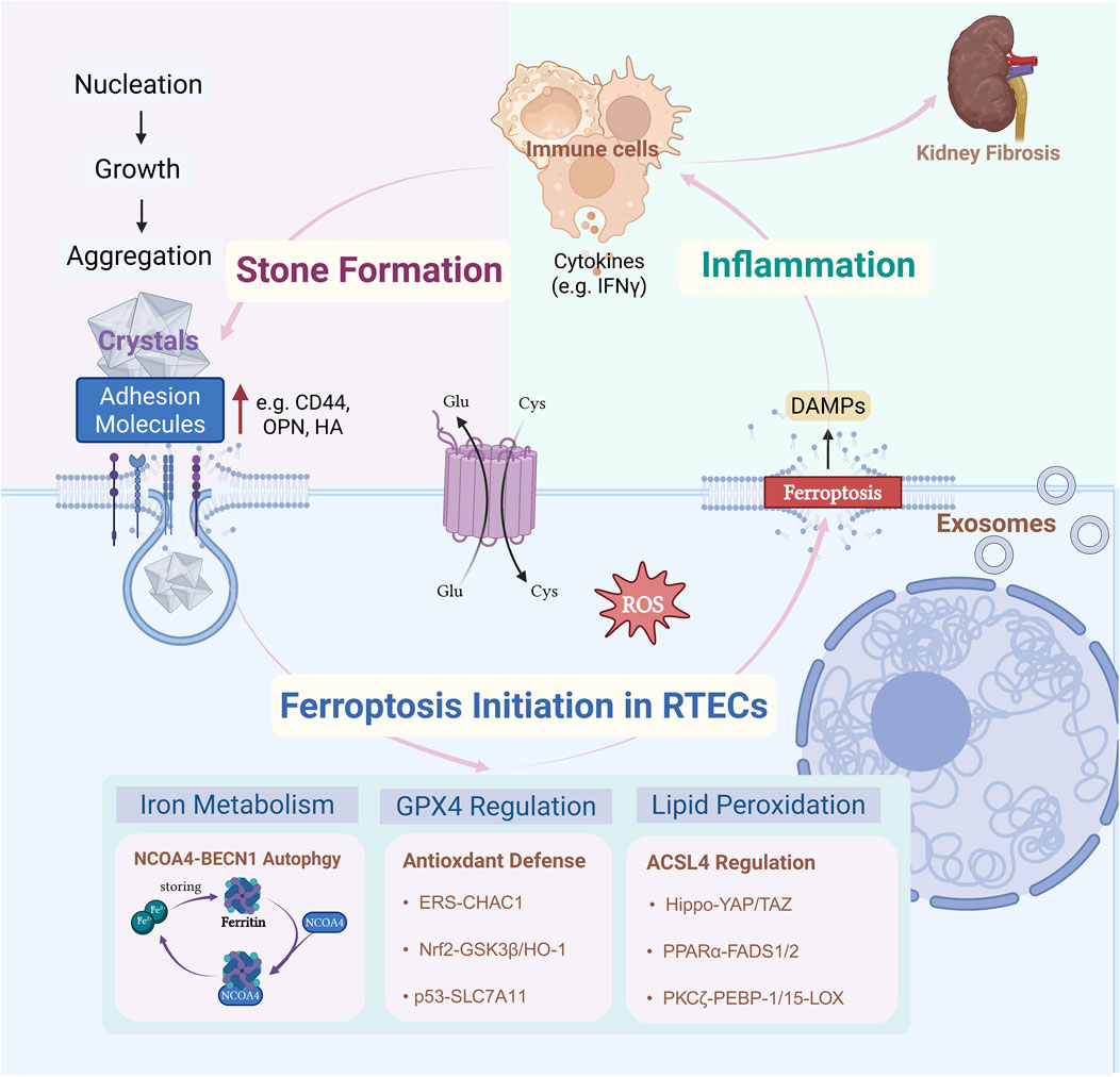 Diagram illustrating the process of stone formation and inflammation leading to ferroptosis in renal tubular epithelial cells. It includes nucleation, growth, and aggregation of crystals with adhesion molecules, immune cells releasing cytokines, and effects such as kidney fibrosis. It shows the roles of iron metabolism, GPX4 regulation, and lipid peroxidation in ferroptosis initiation, highlighting elements like ROS, DAMPs, and exosomes. Key components include adhesion molecules e.g., CD44, OPN, HA; antioxidant defense; and ACSL4 regulation pathways.