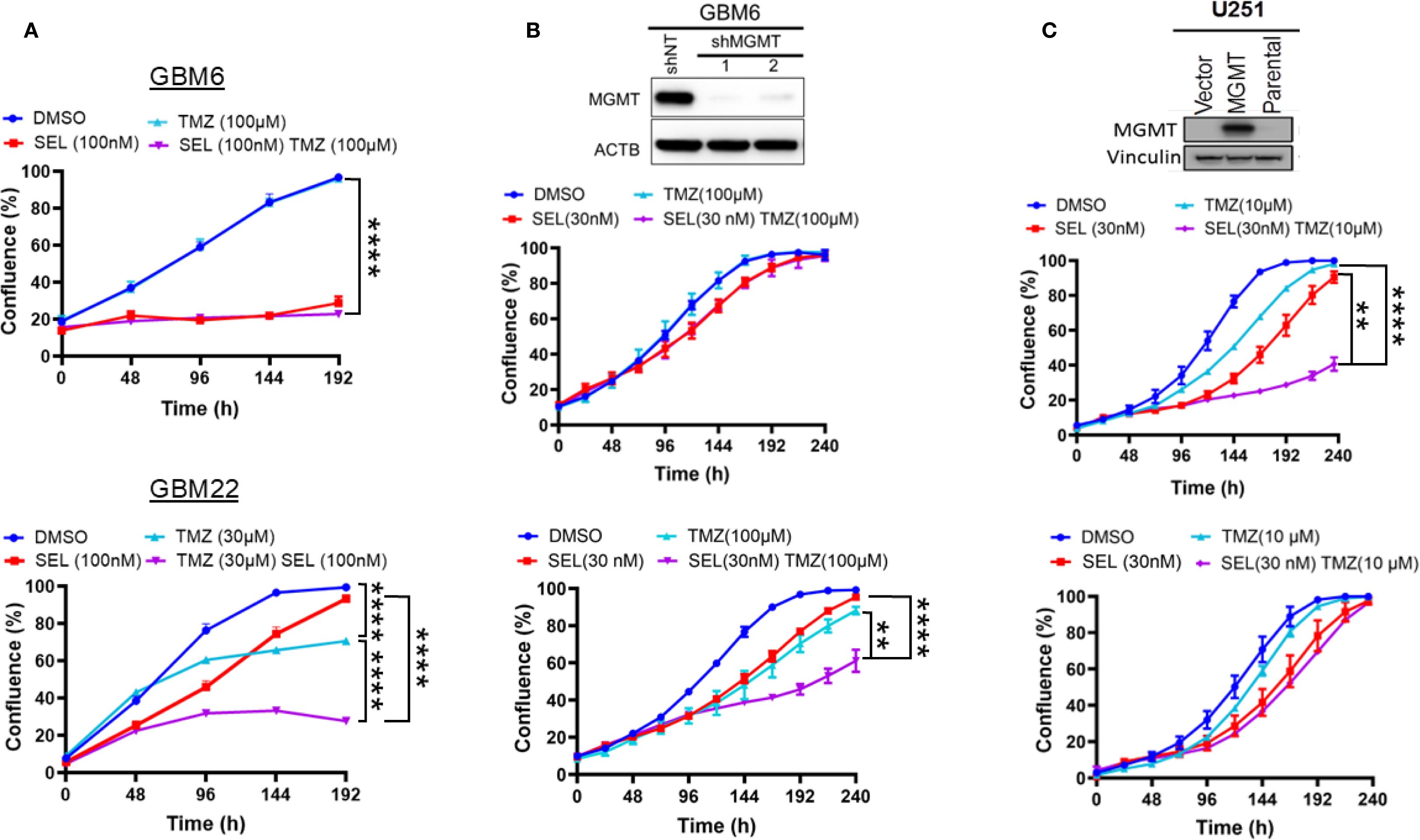 Graphs illustrating the confluence of GBM cell lines under different treatments over time. Panel A: GBM6 cells show decreased confluence with SEL compared to TMZ and DMSO treatments. Panel B: Western blot analysis of MGMT and ACTB for GBM6 shMGMT cells, with confluence graphs showing similar growth patterns for DMSO, TMZ, SEL, and combination treatments. Panel C: U251 cells exhibit different confluence levels under the same treatments, with Western blot for MGMT and Vinculin. Data suggest varying impacts of treatments on cell growth and protein expression across cell lines.