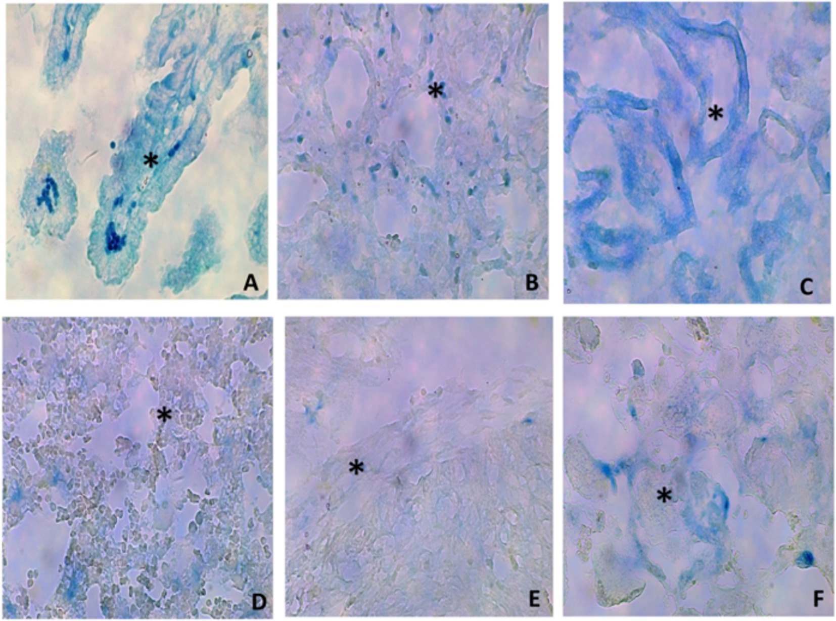 Six micrographs labeled A to F, showing blue-stained areas marked with asterisks. Each panel displays varying textures and densities of tissue or cellular structures, highlighting the presence of specific features under microscopic examination.