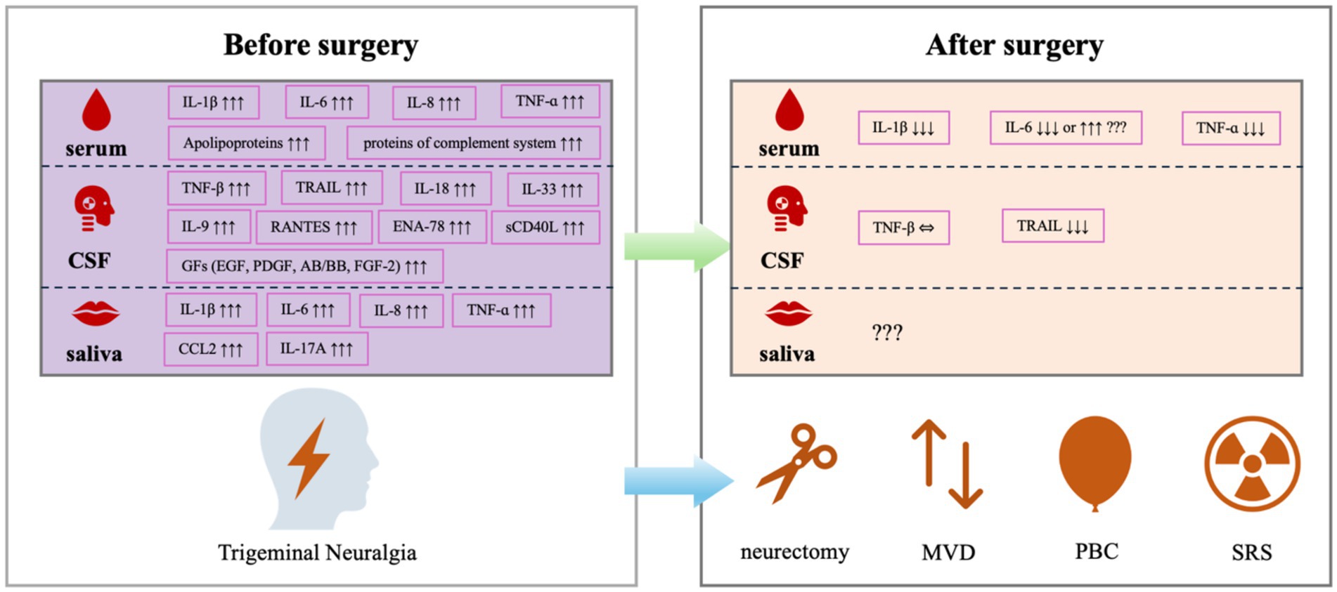 Comparison chart of biomarkers in serum, cerebrospinal fluid (CSF), and saliva before and after surgery for trigeminal neuralgia. Before surgery, various cytokines and proteins are elevated in serum (IL-1β, IL-6, TNF-α), CSF (TNF-β, TRAIL), and saliva (IL-1β, TNF-α). After surgery, these levels decrease or remain unchanged. Surgical options depicted are neurectomy, microvascular decompression (MVD), percutaneous balloon compression (PBC), and stereotactic radiosurgery (SRS), indicated by symbols.