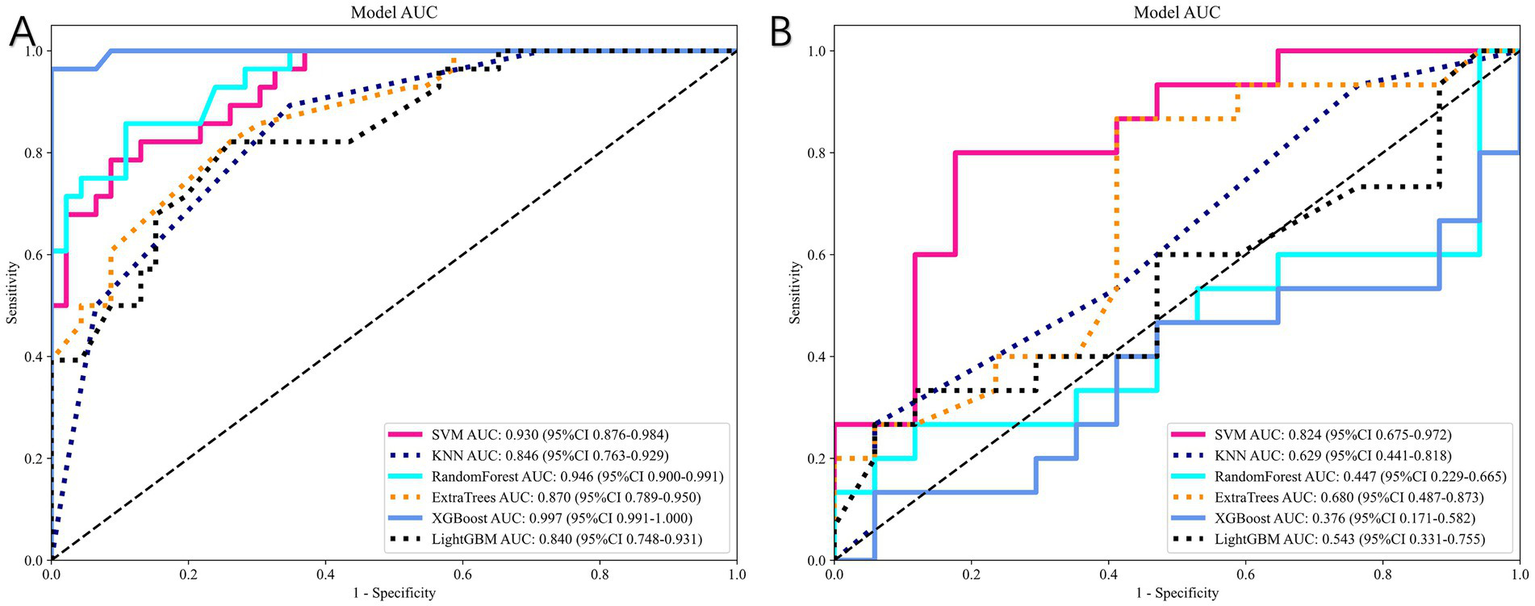Two ROC curves compare model performance. Chart A shows six models with XGBoost performing best (AUC: 0.997). Chart B also features six models, with SVM having the highest AUC at 0.824. Both axes show sensitivity versus 1-specificity.