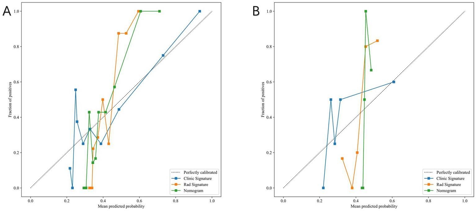 Two calibration plots labeled A and B show the fraction of positives against mean predicted probability. Both plots include three lines representing Clinic Signature (blue), Rad Signature (orange), and Nomogram (green) compared to a dotted line for perfect calibration. The plots display variations in prediction accuracy across models, with axes marked from zero to one.