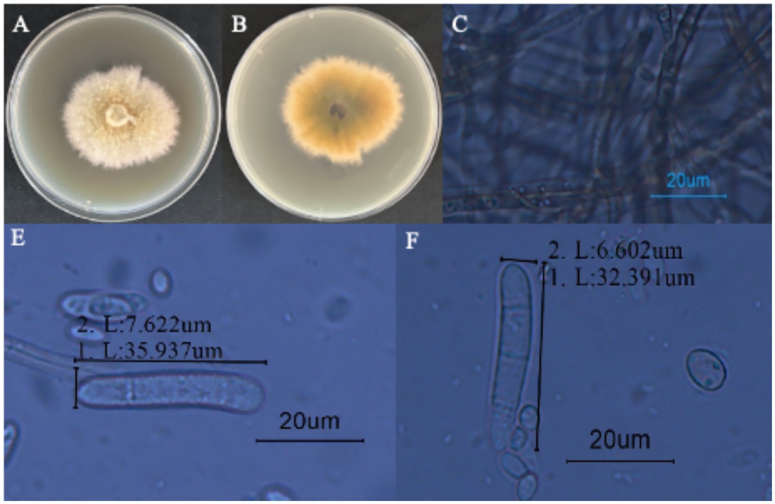 Panels A and B show fungal cultures in petri dishes, with different colorations. Panel C is a microscopic view of fungal hyphae, including a 20 micrometer scale bar. Panel E shows oval-shaped spores, with lengths marked as 35.937 and 7.622 micrometers. Panel F shows elongated fungal cells, with lengths marked as 32.391 and 6.602 micrometers, also including a 20 micrometer scale bar.