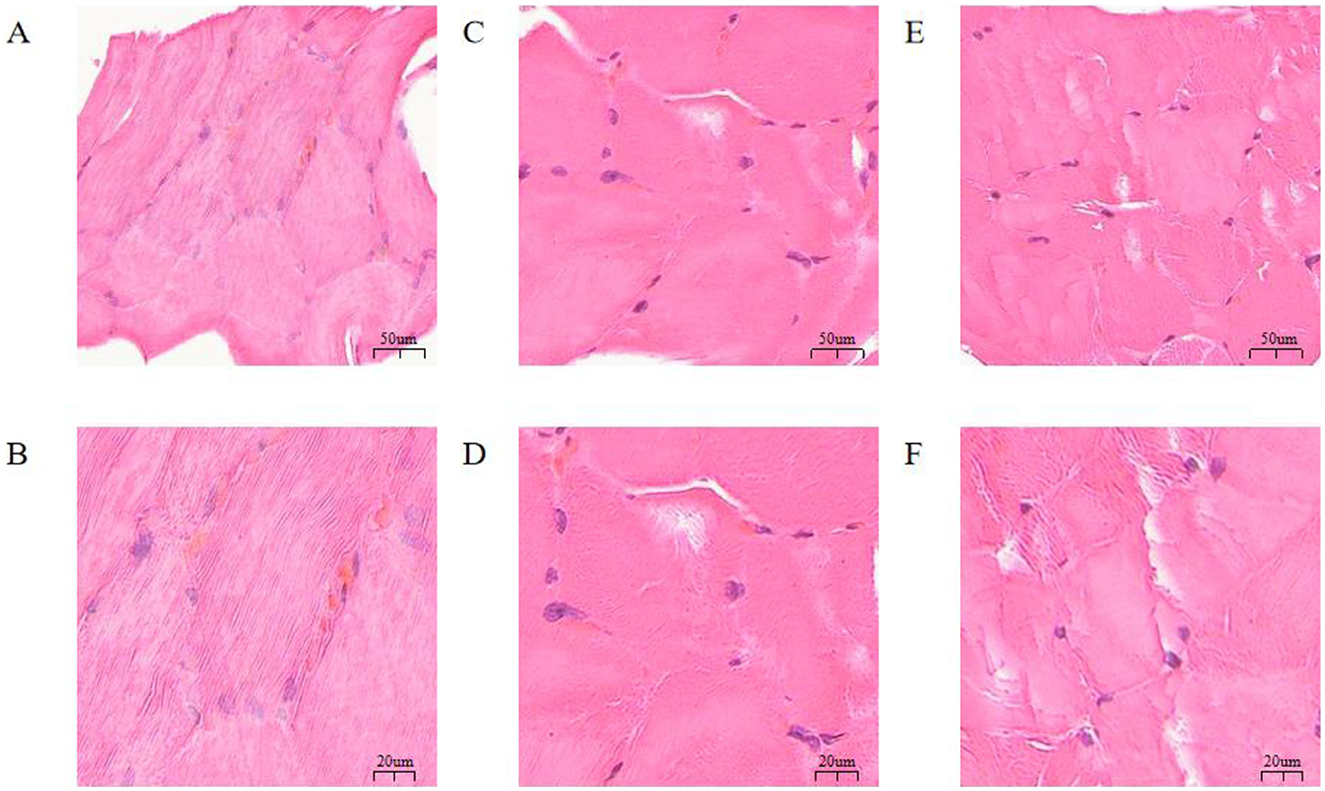 Microscopic images of muscle tissue samples labeled A to F. Each section shows variations in color, structure, and density under a pink and purple stain. Labels A, C, and E show tissues with scale bars of fifty micrometers, while B, D, and F display more detailed textures with scale bars of twenty micrometers.