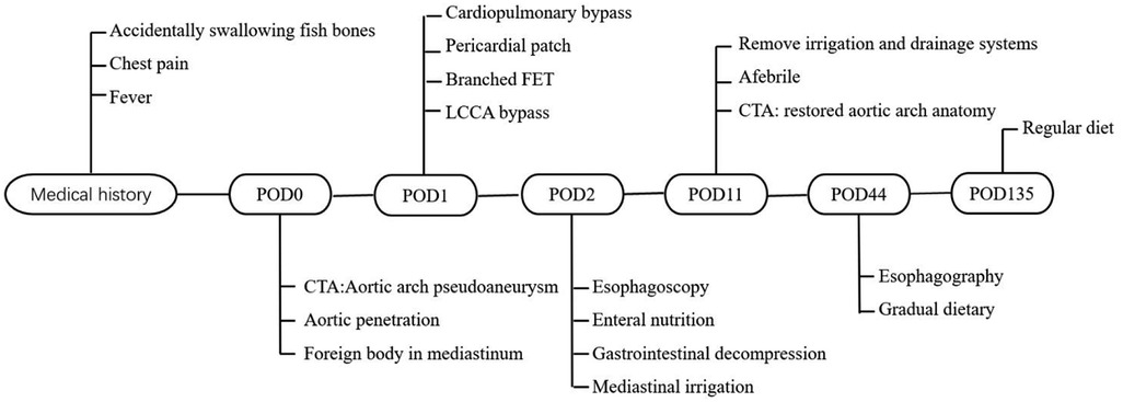 Flowchart outlining a patient's medical history and treatment timeline post fish bone ingestion. It starts with medical history that includes swallowing fish bones, chest pain, and fever. POD0 details cardiopulmonary bypass and other procedures. POD1 notes aortic arch pseudoaneurysm diagnosis. POD2 includes esophagoscopy and enteral nutrition. By POD11, systems are removed and anatomy restored. POD44 involves esophagography and gradual dietary change. POD135 concludes with a return to a regular diet.