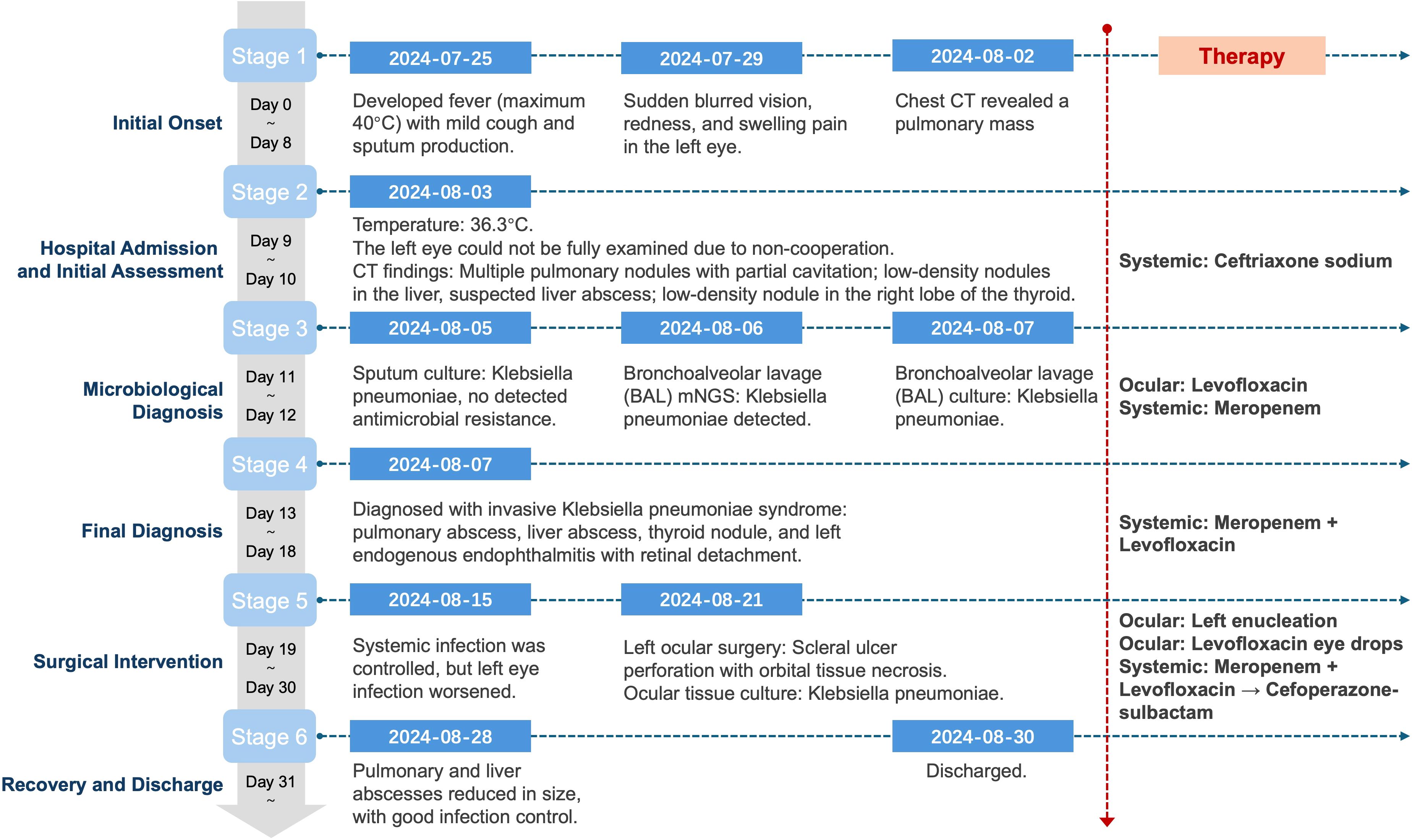 Timeline of a medical case involving six stages: Initial Onset, Hospital Admission, Microbiological Diagnosis, Final Diagnosis, Surgical Intervention, and Recovery. The timeline details symptoms, diagnostic findings, microbiological tests, and treatments, emphasizing a systemic infection, primarily Klebsiella pneumoniae, affecting eyes, lungs, and liver. Key interventions included antimicrobial therapies and ocular surgery, leading to eventual discharge with infection control.
