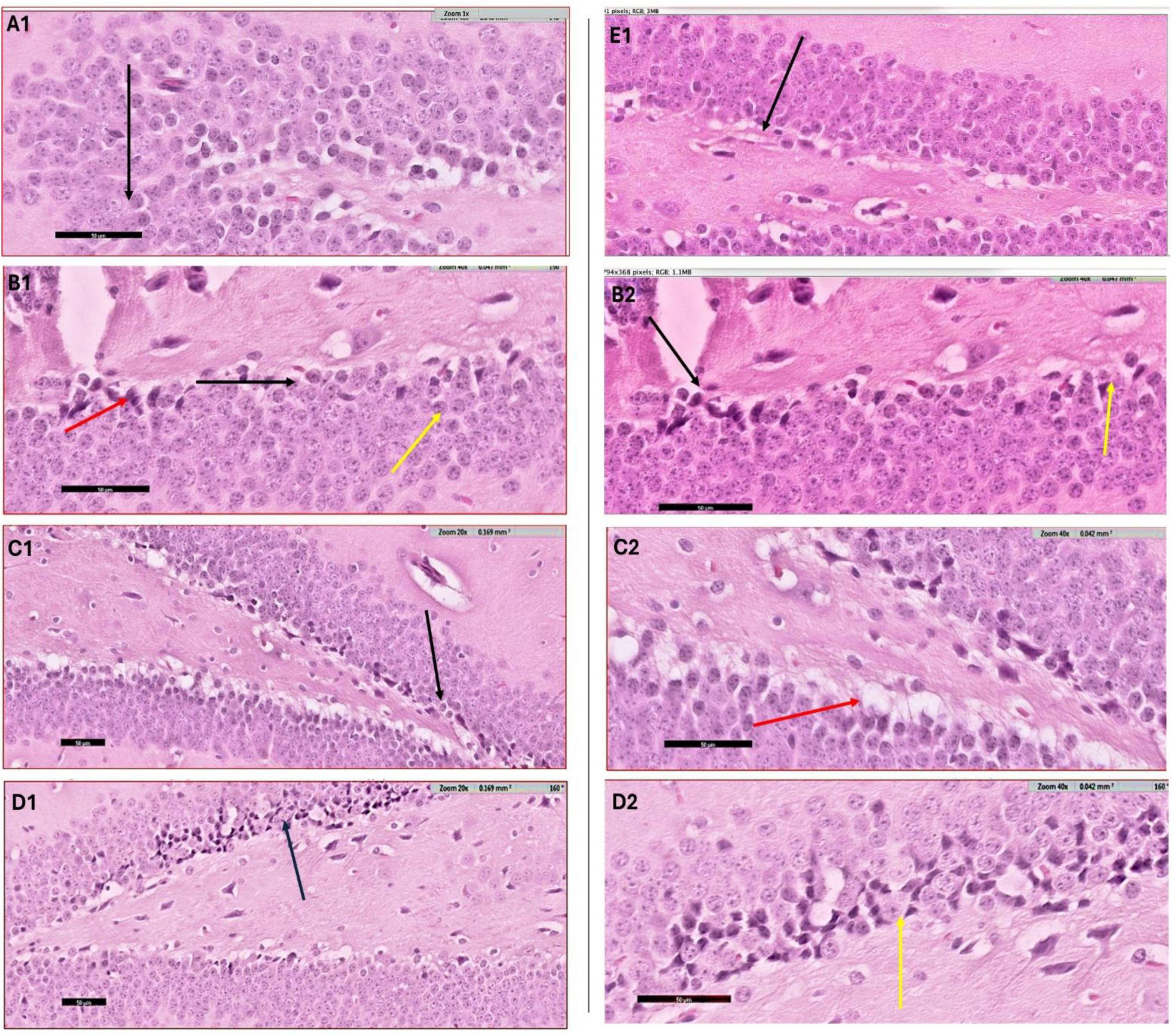 Microscopic images of brain sections labeled A1, B1, C1, D1, E1, B2, C2, and D2. Each section shows varied cellular structures stained in purple hues. Black, red, and yellow arrows indicate specific features or orientations within the tissue. The arrangement highlights diverse cellular organization and morphology across different panels.