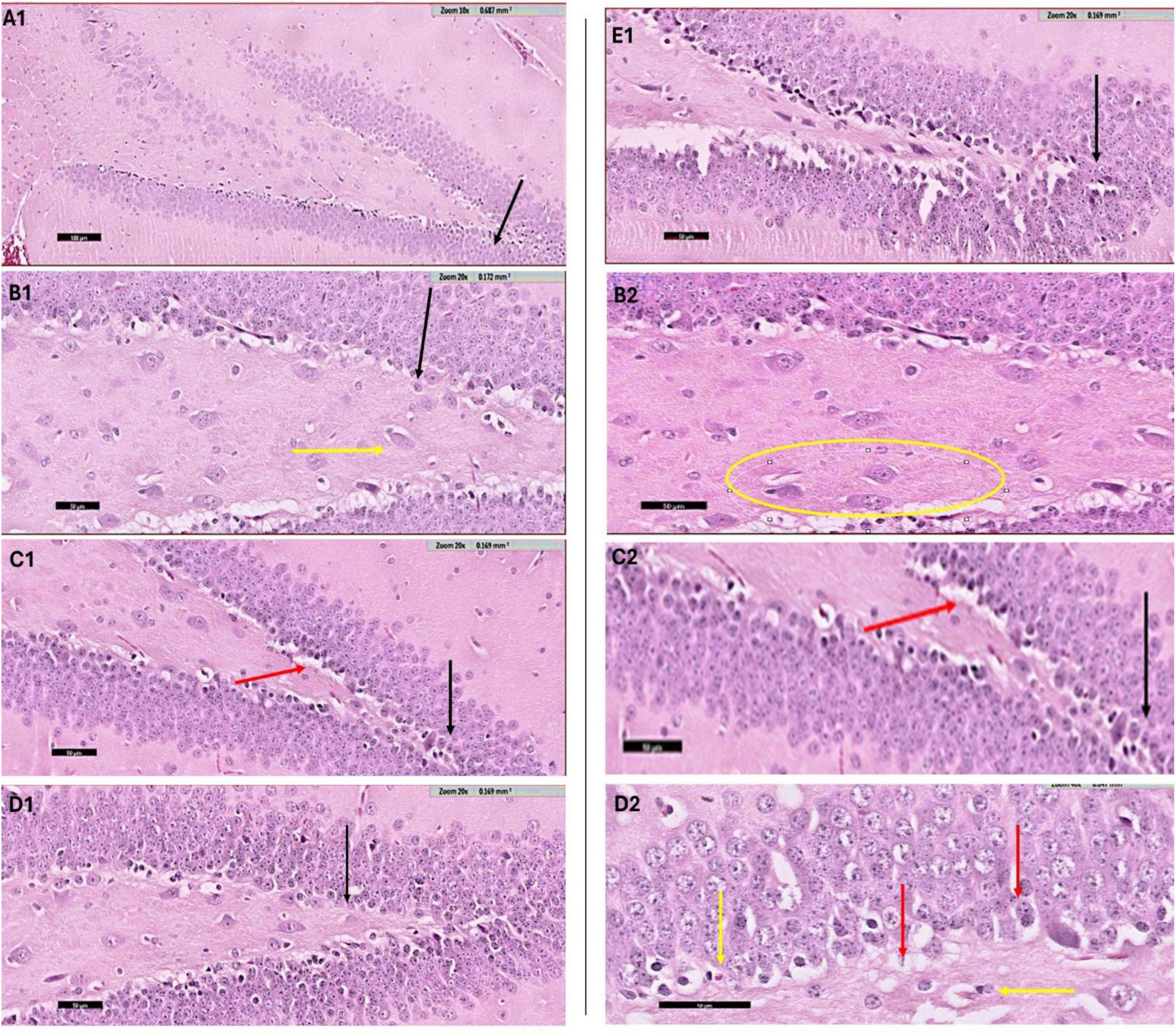 Microscopic images of tissue samples labeled A1 to E1 show various cellular structures. Black, red, and yellow arrows, and circles highlight specific features within the cells, possibly indicating regions or differences in tissue types. Each section appears to be at different magnifications or focal areas, illustrating intricate details in the tissue’s histology.