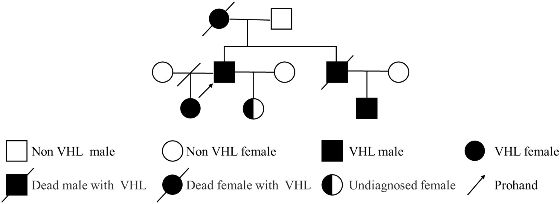 Pedigree chart illustrating a family with Von Hippel-Lindau (VHL) disease. Symbols indicate gender and status: squares for males and circles for females. Shaded symbols represent individuals with VHL, open symbols are non-VHL, and a diagonal line indicates deceased. Half-shaded symbols denote undiagnosed females. An arrow points to the proband.