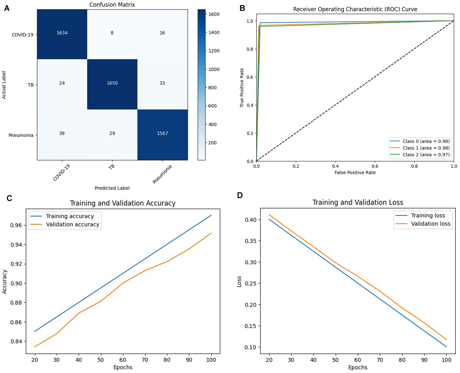 Panel A shows a confusion matrix for classifying COVID-19, TB, and Pneumonia. Panel B depicts the ROC curve with high AUC values for all classes. Panel C presents training and validation accuracy increasing over 100 epochs. Panel D illustrates the decrease in training and validation loss over the same epochs.