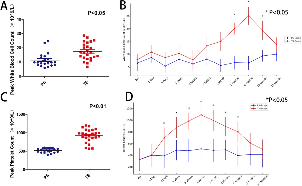 Bar chart comparing PS and TS groups for benign tumor patients. Categories include thrombocytosis, leukocytosis, PVT, operative time, hospital stay, and blood loss. PS is shown in blue and TS in orange. P-values indicate statistical significance: thrombocytosis and leukocytosis show significant differences with p-values of 0.003 and 0.007 respectively. Other categories have higher p-values, indicating less statistical significance.