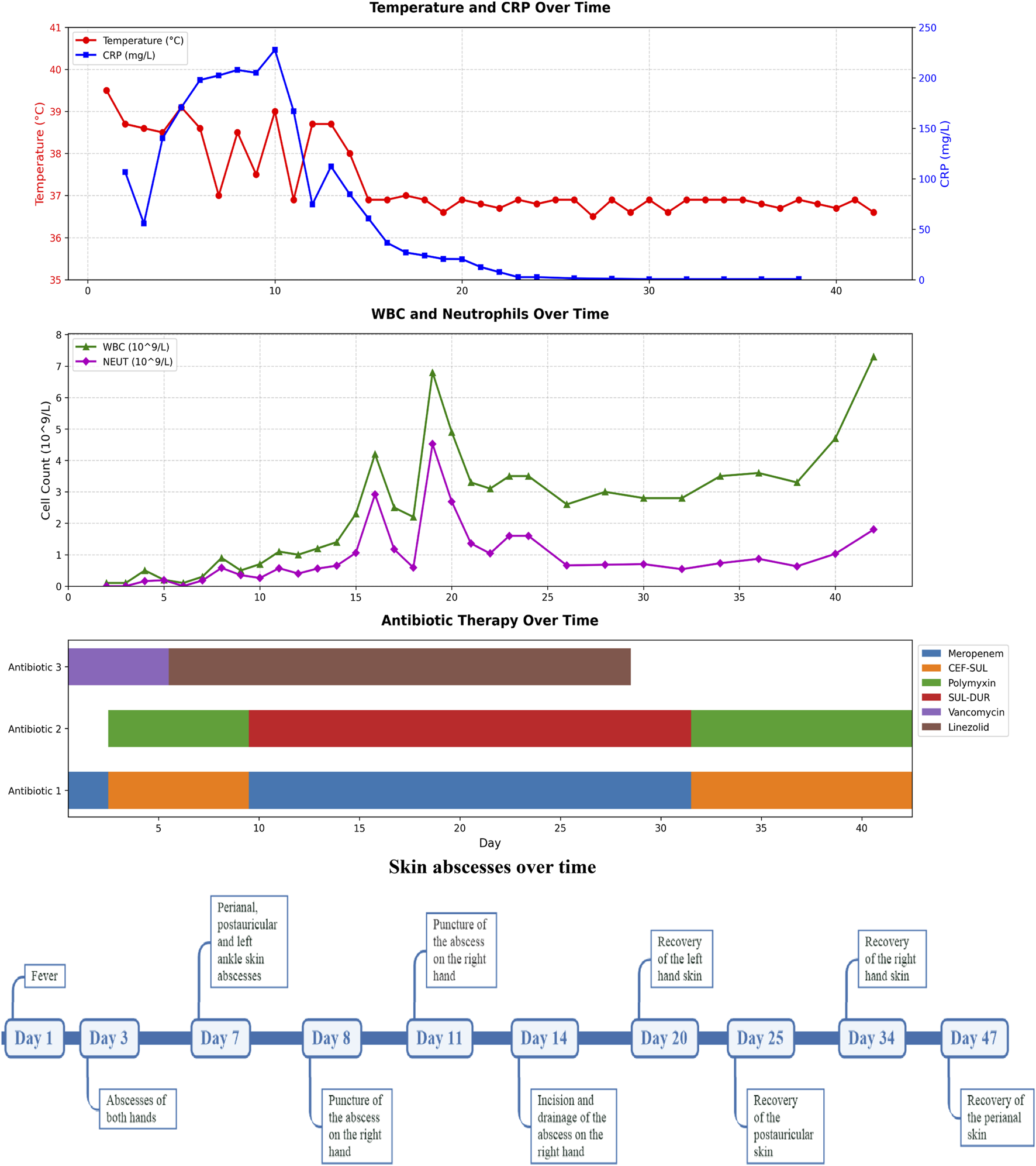A set of graphs and timelines detail a medical treatment over time. The first graph shows Temperature (red line) and CRP levels (blue line) declining after day 10. The second graph depicts WBC (green line) and Neutrophils (purple line) fluctuating, with peaks around day 10 and 30. The antibiotic therapy timeline lists Meropenem, CEF-SUL, Polymyxin, SUL-DUR, Vancomycin, and Linezolid with varying durations. Finally, a timeline of skin abscesses outlines tests and recoveries over 47 days, with significant events like abscess punctures and recoveries noted.