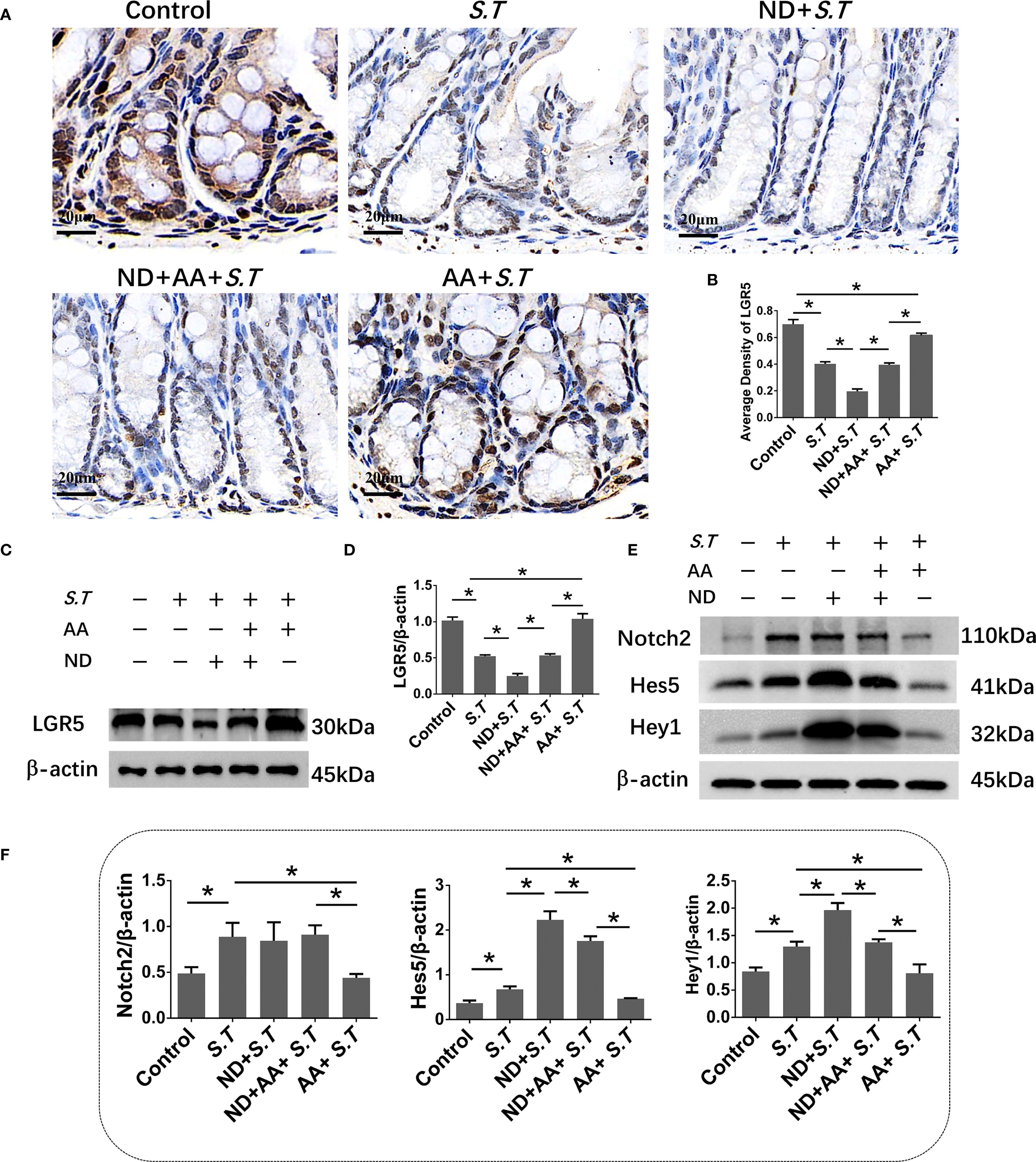 Panels A-E show various analyses related to LGR5 expression and Notch signaling pathways, with bar graphs and blots indicating protein expression levels under different treatment conditions. Immunohistochemistry images display tissue sections with varying LGR5 staining. Graphs in B, D, and F illustrate quantified protein levels with statistical significance marked. Images and data collectively assess the effects of different conditions on LGR5, Notch2, Hes5, and Hey1 expression, using a control and experimental groups labeled with S.T, ND, and AA designations.