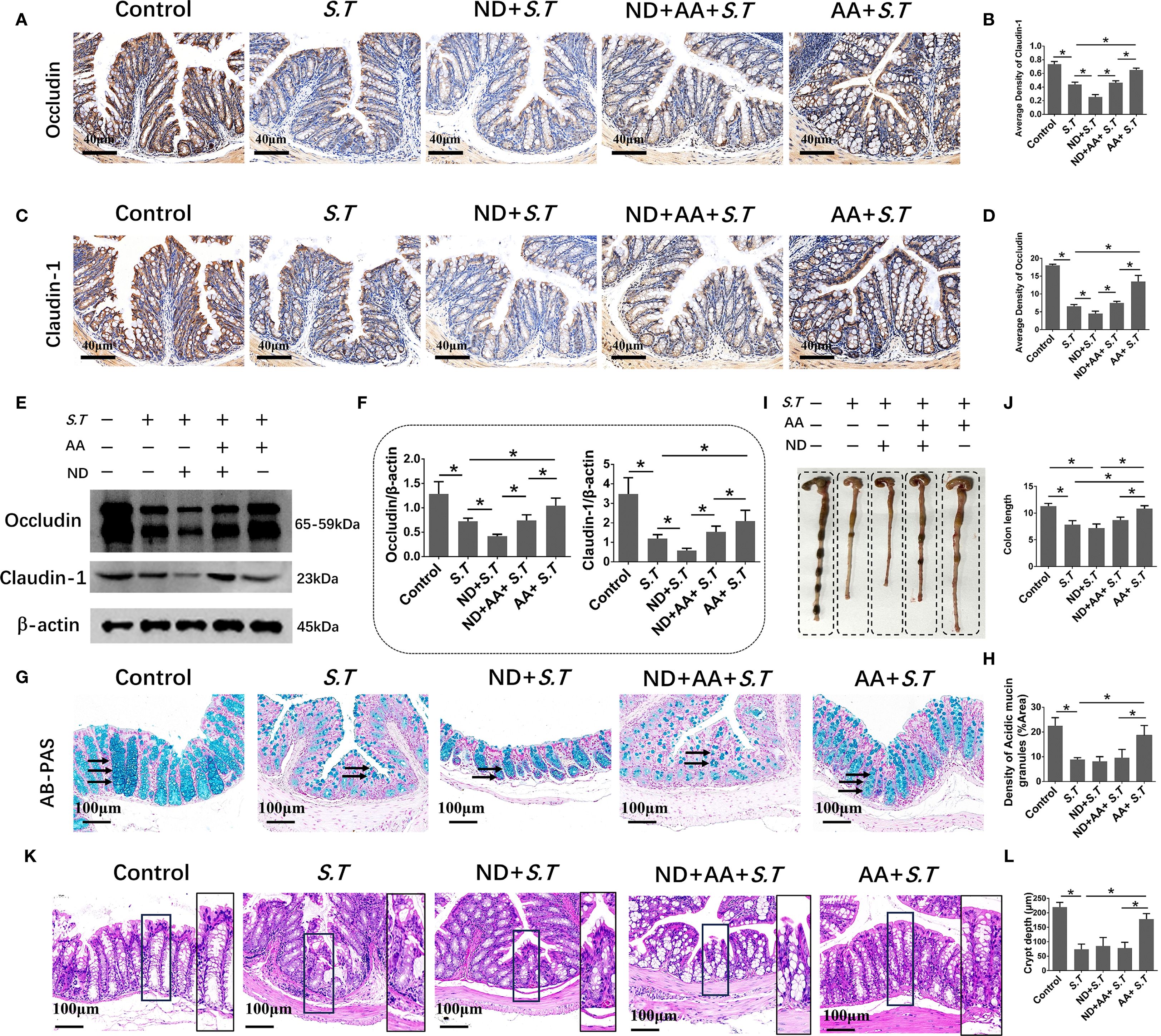 Panels show microscopic images and graphs of intestinal tissues with various treatments, labeled as Control, S.T, ND+S.T, ND+AA+S.T, and AA+S.T. Panels A, C, G, and K display stained tissue sections. Panels B, D, F, H, J, and L provide bar graphs with statistical analysis, indicating differences in protein expression, colon length, mucin density, and crypt depth across treatments. Panel E shows a Western blot for occludin and claudin-1 proteins. Panel I displays segmented intestinal sections. Statistical significance is indicated by asterisks.