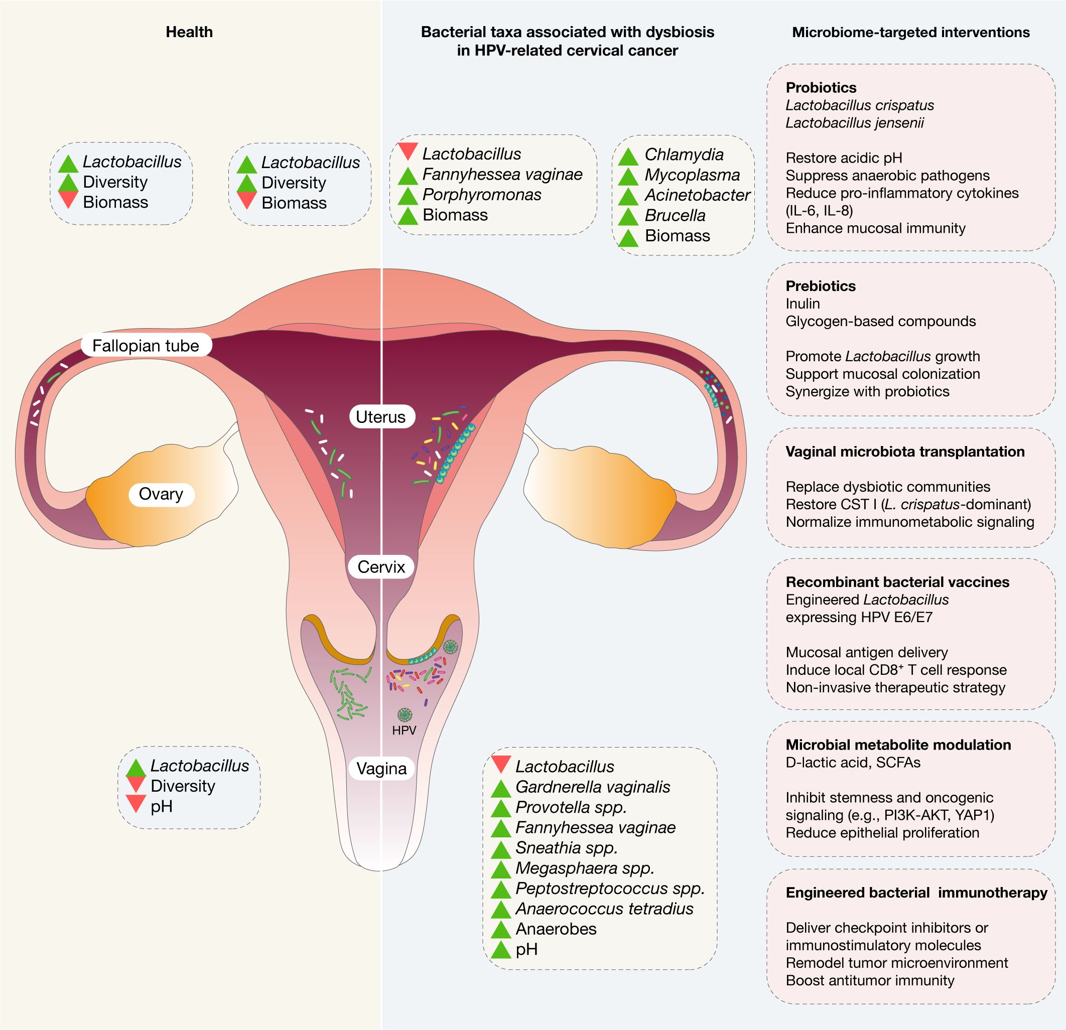 Illustration comparing healthy and dysbiotic vaginal microbiomes in HPV-related cervical cancer. The left side indicates health with Lactobacillus dominance. The right shows increased diversity with various harmful bacteria. Microbiome-targeted interventions include probiotics, prebiotics, vaginal microbiota transplantation, recombinant bacterial vaccines, microbial metabolite modulation, and engineered bacterial immunotherapy.