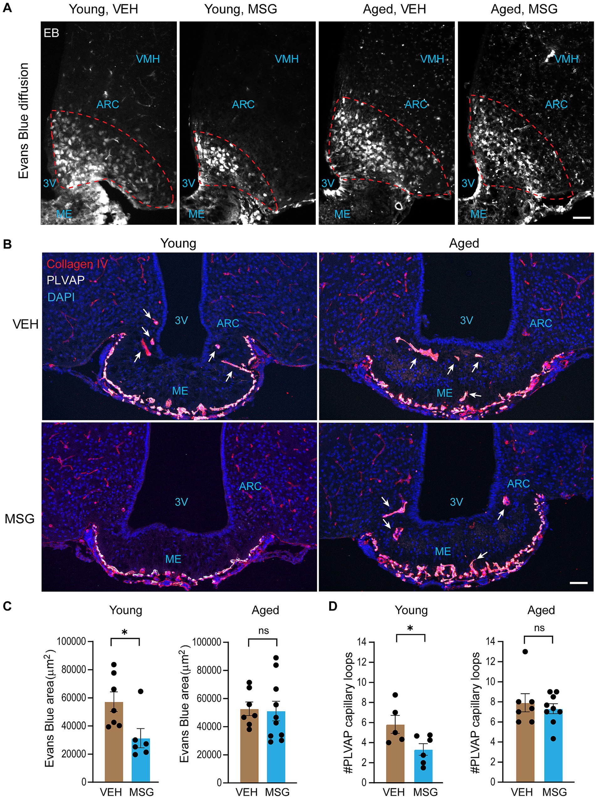 Panel A shows Evans Blue diffusion images in young and aged mice treated with VEH or MSG, highlighting areas in the mediobasal arcuate nucleus. Panel B displays immunofluorescence staining of collagen IV, PLVAP, and DAPI in young and aged groups, with arrows indicating specific structures. Panels C and D present bar graphs comparing Evans Blue area and PLVAP capillary loops across different conditions, marked with significance indicators.