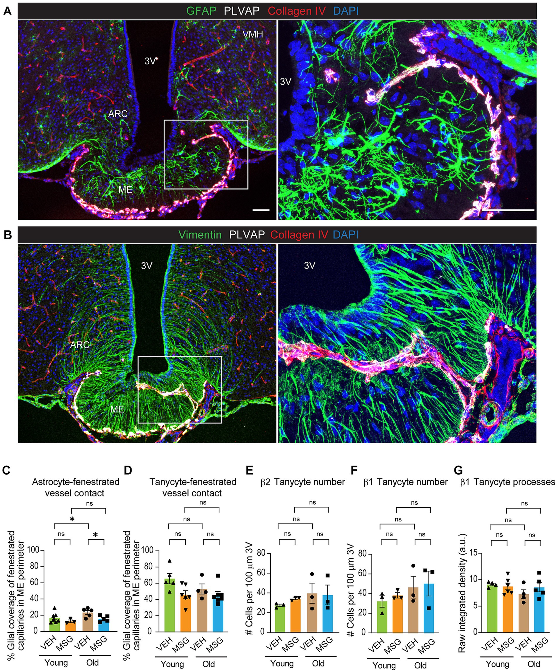 Fluorescent microscopy images and bar graphs analyzing brain tissue. Images A and B show labeled regions: ARC, ME, VMH, and 3V, with markers for GFAP, Vimentin, PLVAP, Collagen IV, and DAPI, indicating cell structures and proteins. Enlarged insets highlight cellular details in the median eminence. Graphs C to G display data on astrocyte and tanycyte interactions with vessels, showing percentage coverage, cell count, and density in young and old groups treated with VEH and MSG, marked with significance indicators.