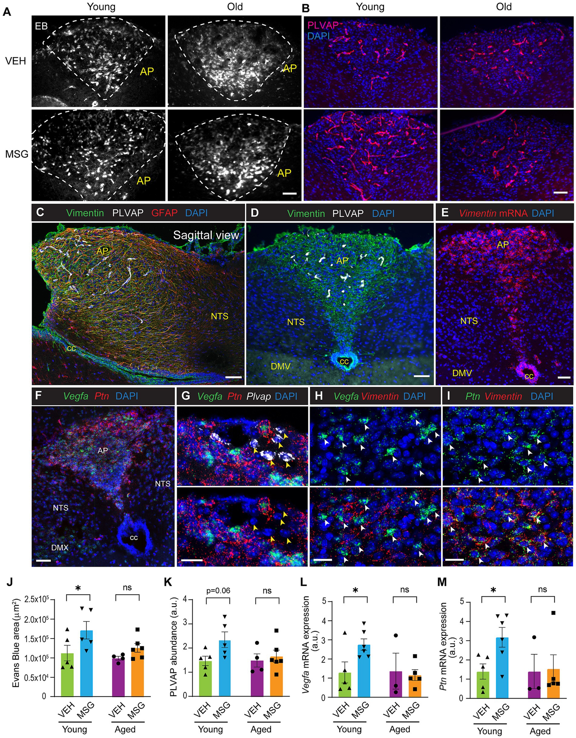 A series of scientific images displaying molecular and cellular analysis in young and old samples. Panels A-I depict various markers and stains like Evans Blue, PLVAP, Vimentin, and others, highlighting differences in staining and cellular organization. Panels J-M present bar graphs comparing metrics like Evans Blue area, PLVAP abundance, and Vegfa and Ptn mRNA expression across vehicle and MSG-treated groups, with distinctions between young and aged samples. The data suggests differential expression and staining patterns associated with age and treatment.