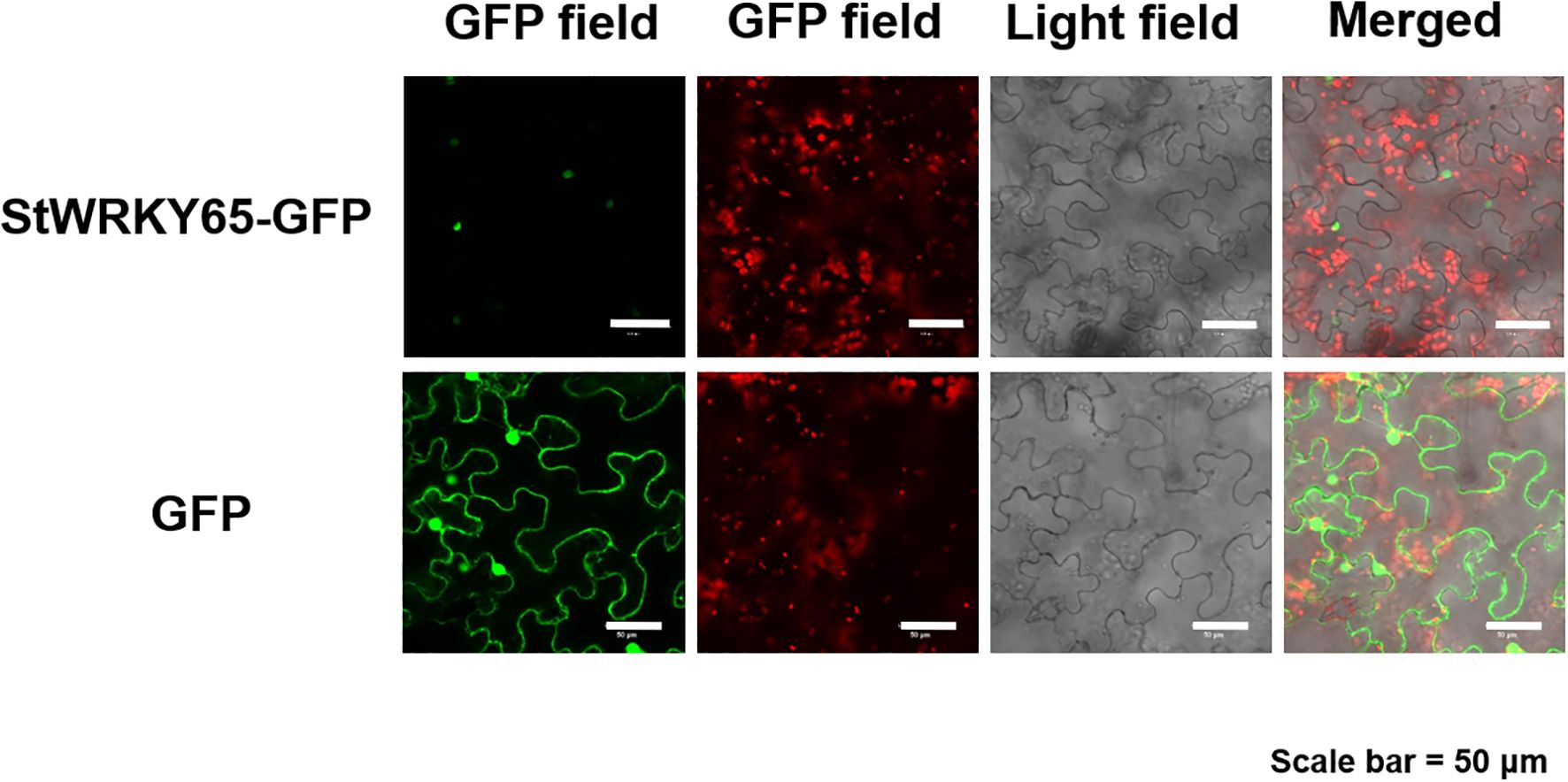 Microscopic images showing fluorescence for StWRKY65-GFP and GFP. The top row displays the GFP field with faint green fluorescence, red fluorescence, a light field, and a merged image with both colors. The bottom row similarly shows strong green fluorescence for GFP, a red fluorescence field, a light field, and a merged image with visible green outlines and red spots. A scale bar indicates 50 micrometers.