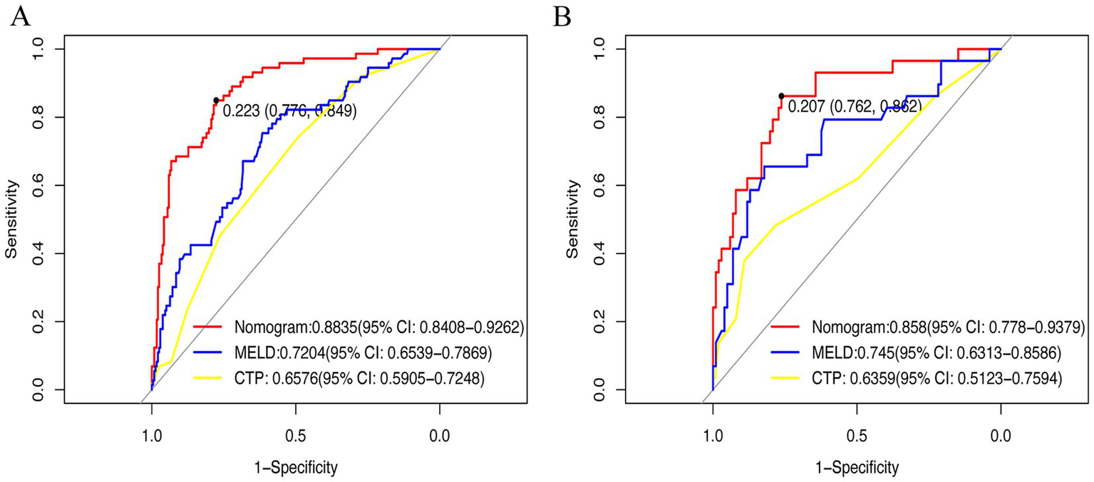 Two ROC curve plots comparing different models: Panel A and Panel B both show sensitivity versus 1-specificity. Three models are plotted: Nomogram (red), MELD (blue), and CTP (yellow). In Panel A, Nomogram has the highest AUC of 0.8835, followed by MELD at 0.7204, and CTP at 0.6576. In Panel B, Nomogram scores 0.858, MELD 0.745, and CTP 0.6359. Confidence intervals are displayed for each model's AUC.
