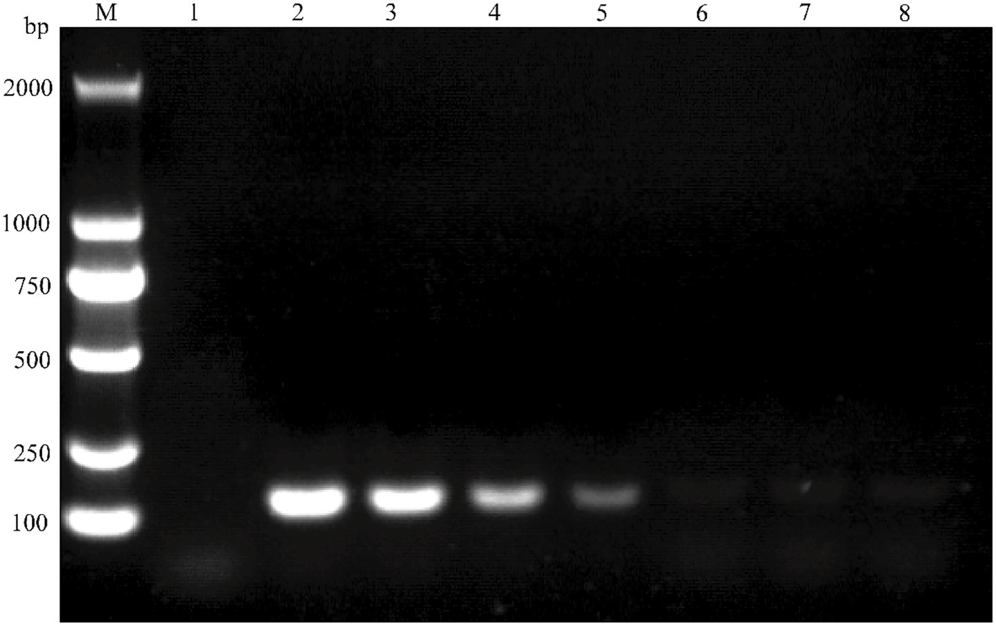 Gel electrophoresis image showing a DNA ladder in the first lane marked