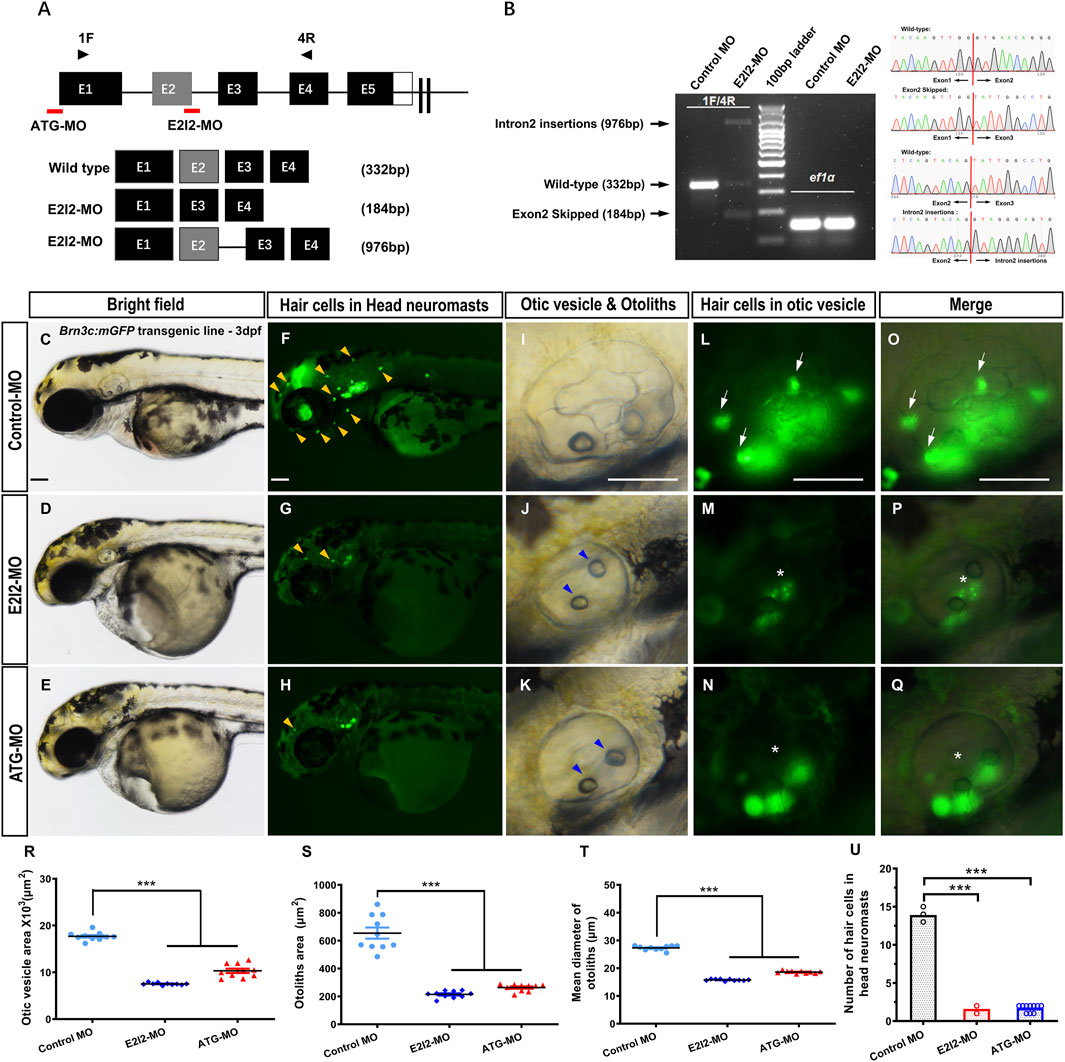 Schematic and experimental analysis of gene knockdown effects using morpholinos in zebrafish embryos. Part A shows gene structures targeted by ATG-MO and E2I2-MO. Part B illustrates PCR and sequencing results for transcript analysis. Panels C-E display brightfield images of control and morpholino-treated embryos. F-H depict hair cells labeled with green fluorescence in head neuromasts. I-K illustrate otic vesicle and otolith structures. L-N show fluorescent labeling of hair cells in otic vesicles. O-Q present merged images. Graphs R-U quantify otic vesicle area, otolith area, hair cell count, and otolith diameter, with significant differences marked.