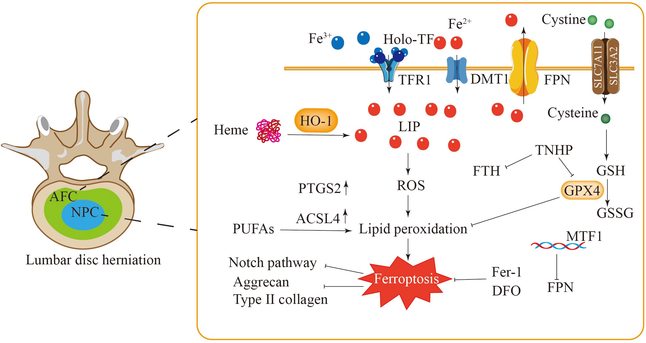 Diagram illustrating the cellular mechanism of ferroptosis in lumbar disc herniation. It shows interactions between various elements such as iron (Fe³⁺ and Fe²⁺), transport proteins (TFR1, DMT1, FPN), and pathways related to lipid peroxidation. Key components include HO-1, LIP, ROS, PUFA metabolism, GPX4, and MTF1, leading to ferroptosis, with influences from pathways involving notch, aggrecan, and type II collagen. The image emphasizes cellular pathways and mediators contributing to cell death in disc herniation.