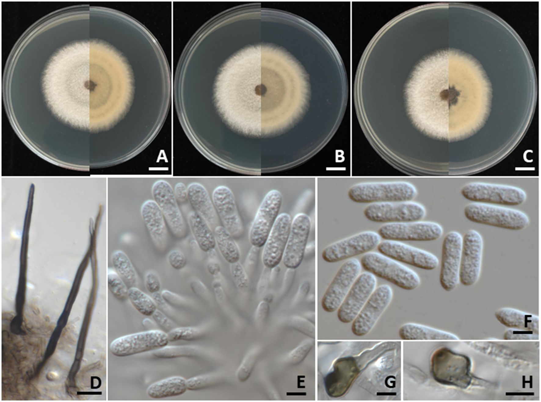 Petri dishes in panels A, B, and C display fungal cultures with segmented growth patterns. Panel D shows elongated, dark fungal structures. Panels E and F feature oval-shaped spores. Panels G and H present close-ups of spore-producing structures. The images emphasize the morphology and growth of the fungus across different stages and views.