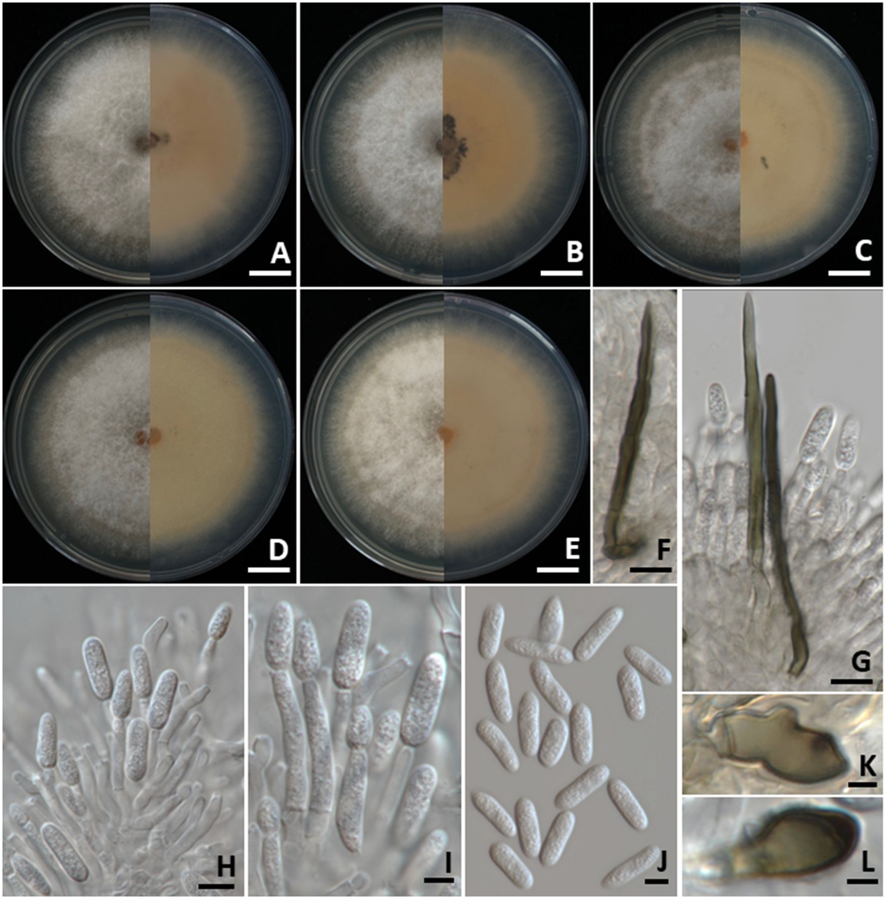Petri dishes A to E show fungal growth on culture media, each displaying a half-circle division with varying textures and colors. Panels F to I depict close-up images of fungal structures, including hyphae and spores. Panels J to L display spores and other fungal elements under magnification. Each panel provides a detailed view for fungal morphology study.