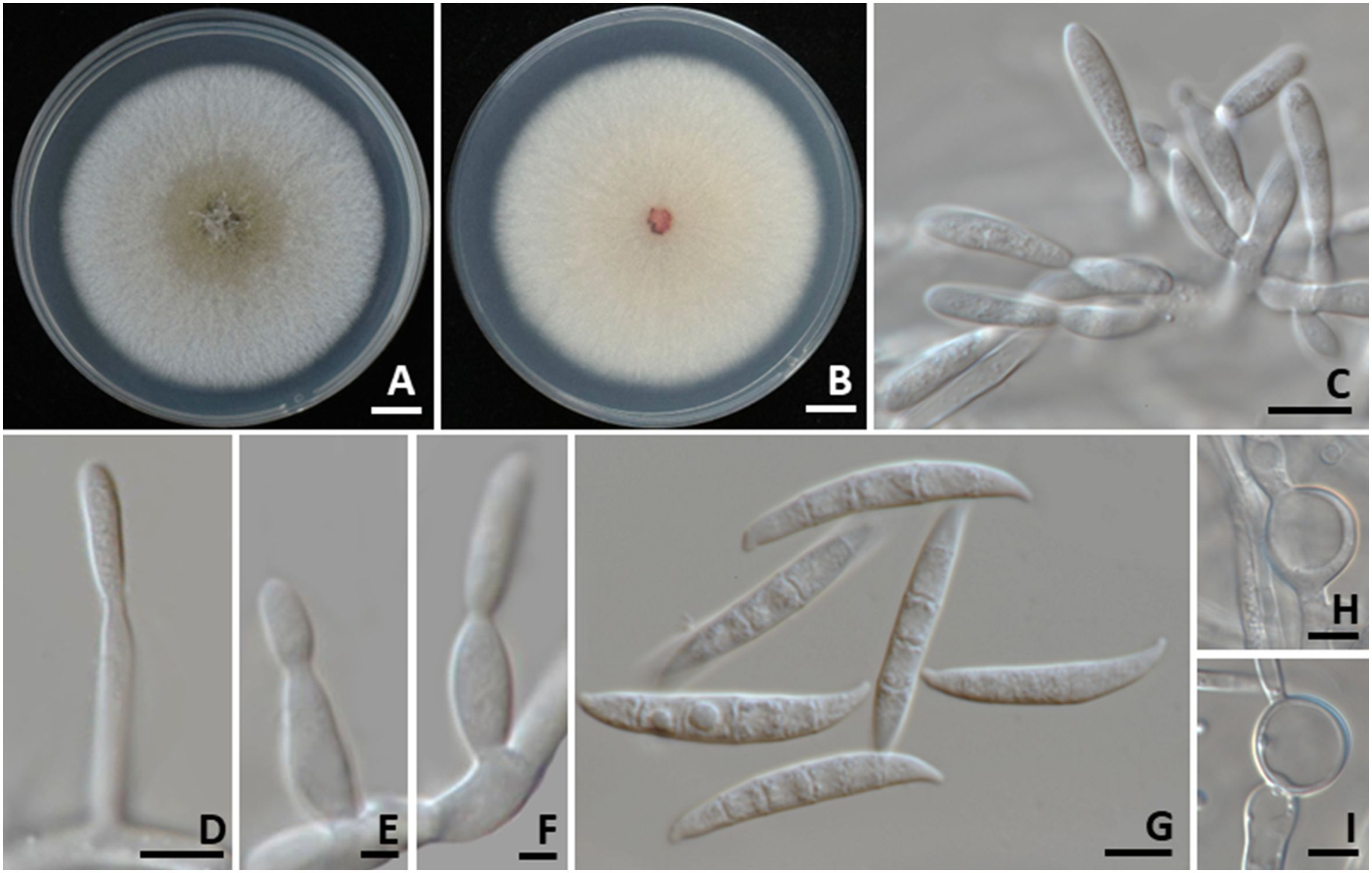 Eight-panel image showing fungal growth. Panels A and B display fungal colonies in petri dishes with white, fluffy textures. Panels C, D, E, F, and G present microscopic views of fungal spores or structures, elongated and smooth. Panels H and I show close-up views of rounded, translucent fungal cells, possibly conidiophores or other similar structures.