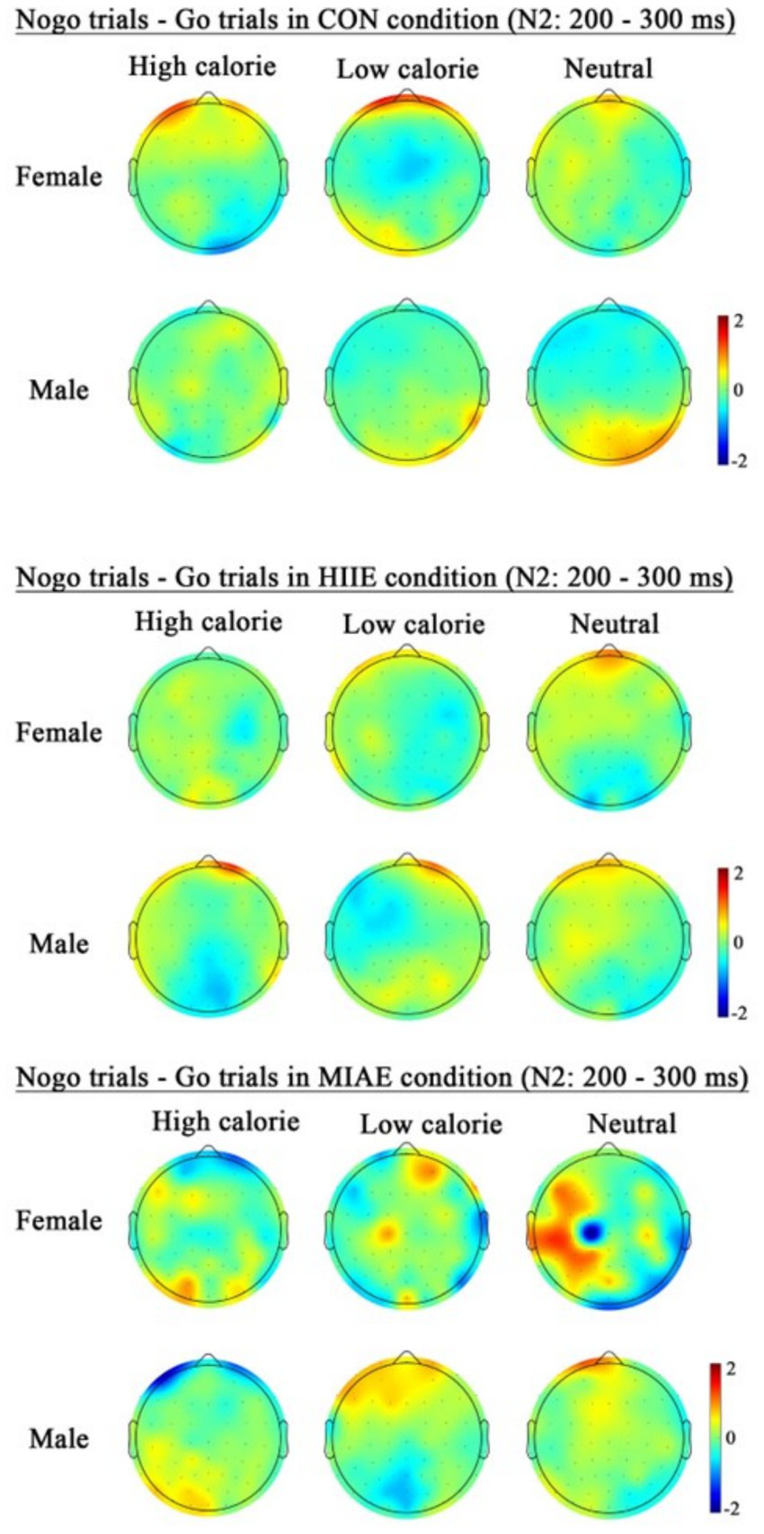 Topographic maps show nogo trials during go trials in CON, HIIE, and MIAE conditions for high, low calorie and neutral stimuli. Each condition is divided by gender, displaying brain activity from negative two to two microvolts.