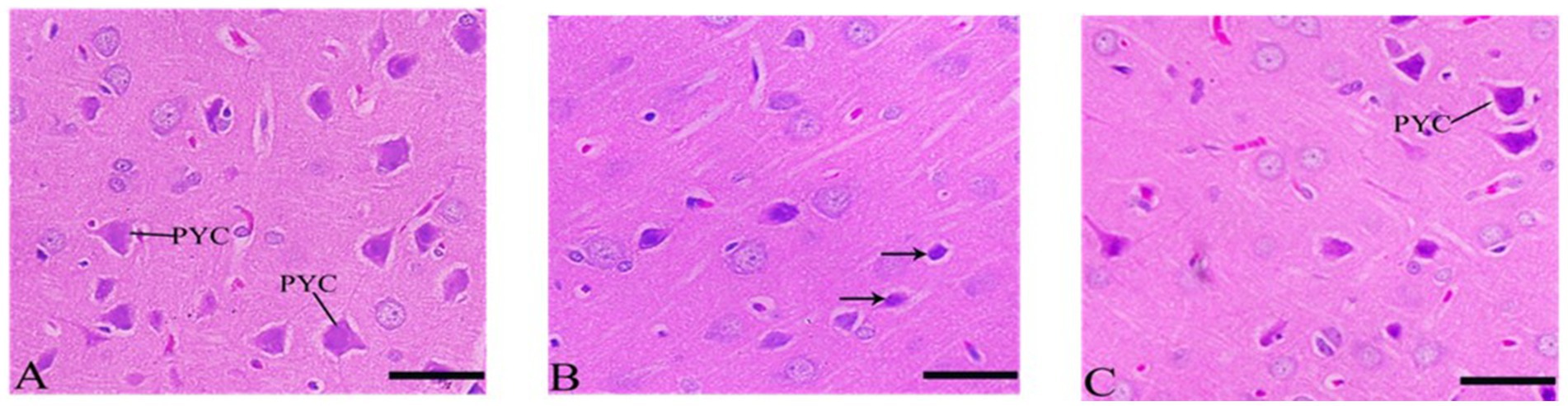 Histological sections of brain tissue stained in pink and purple. Image A shows neurons labeled
